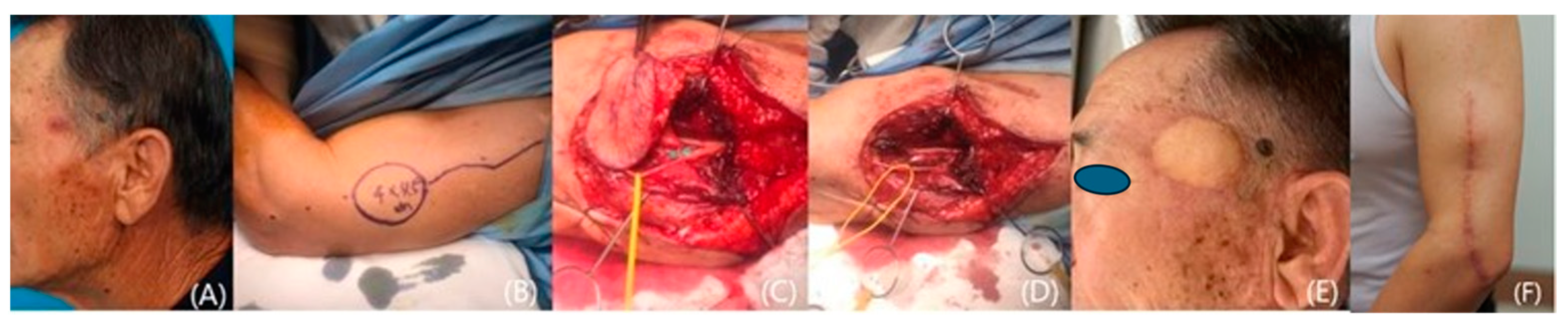 Medicina 60 02082 g004