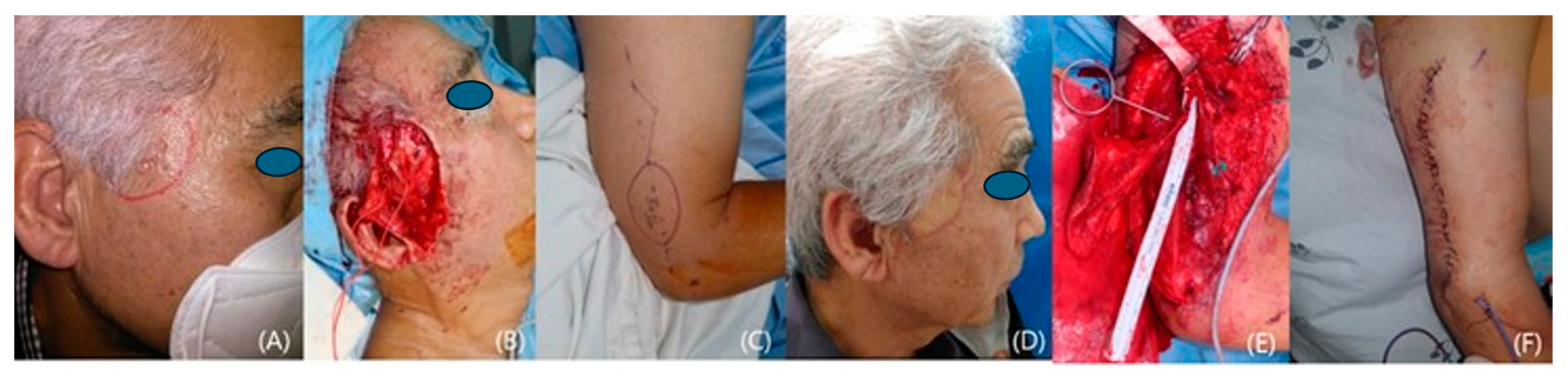 Medicina 60 02082 g005