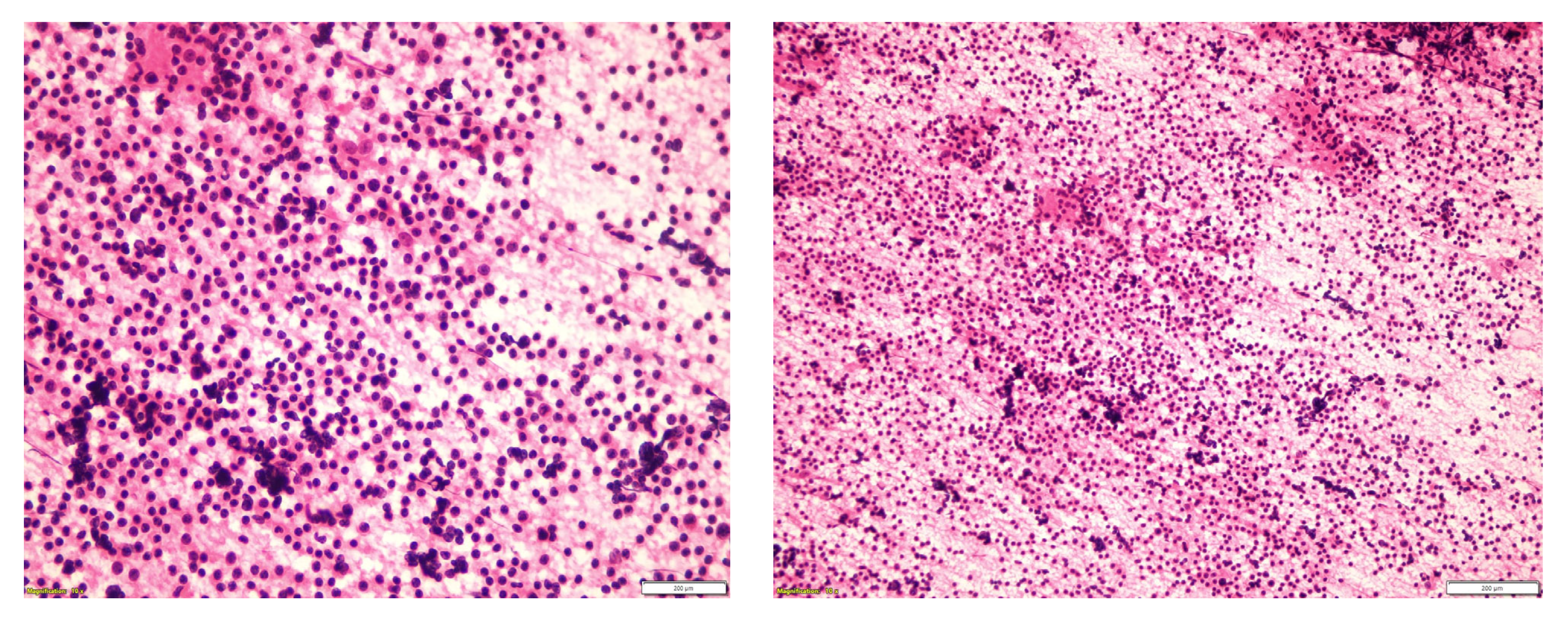 Medicina 60 02086 g001