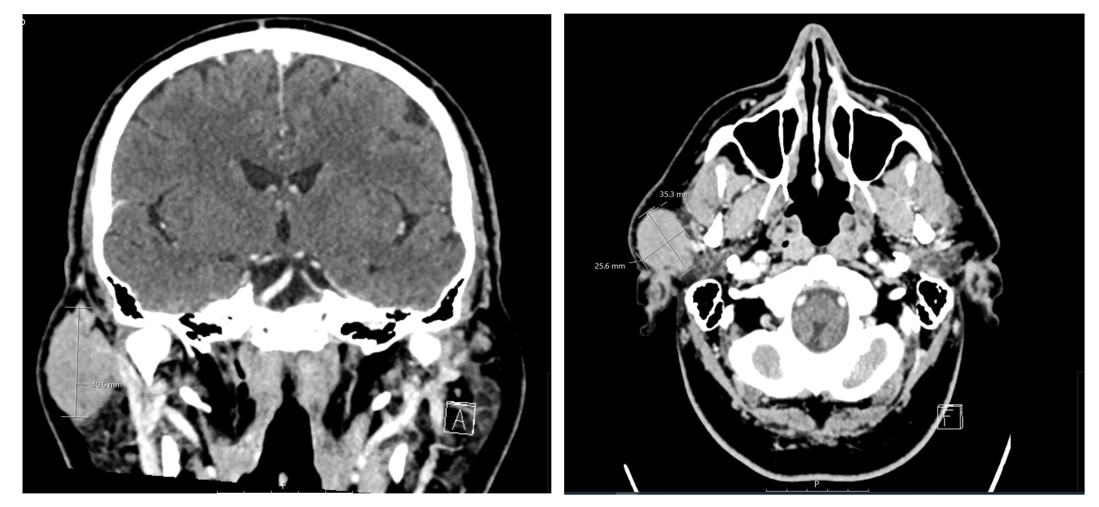 Medicina 60 02086 g002