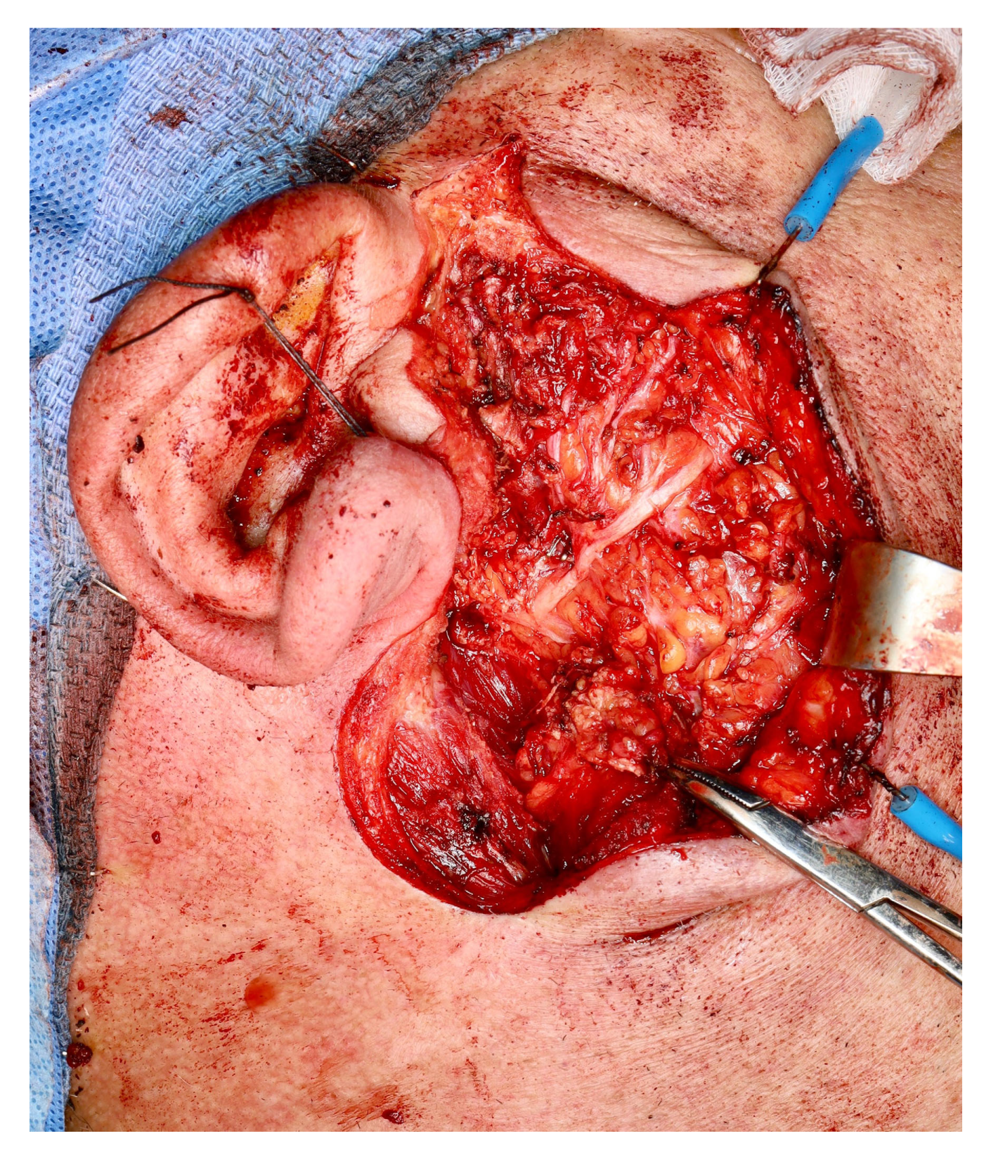 Medicina 60 02086 g003