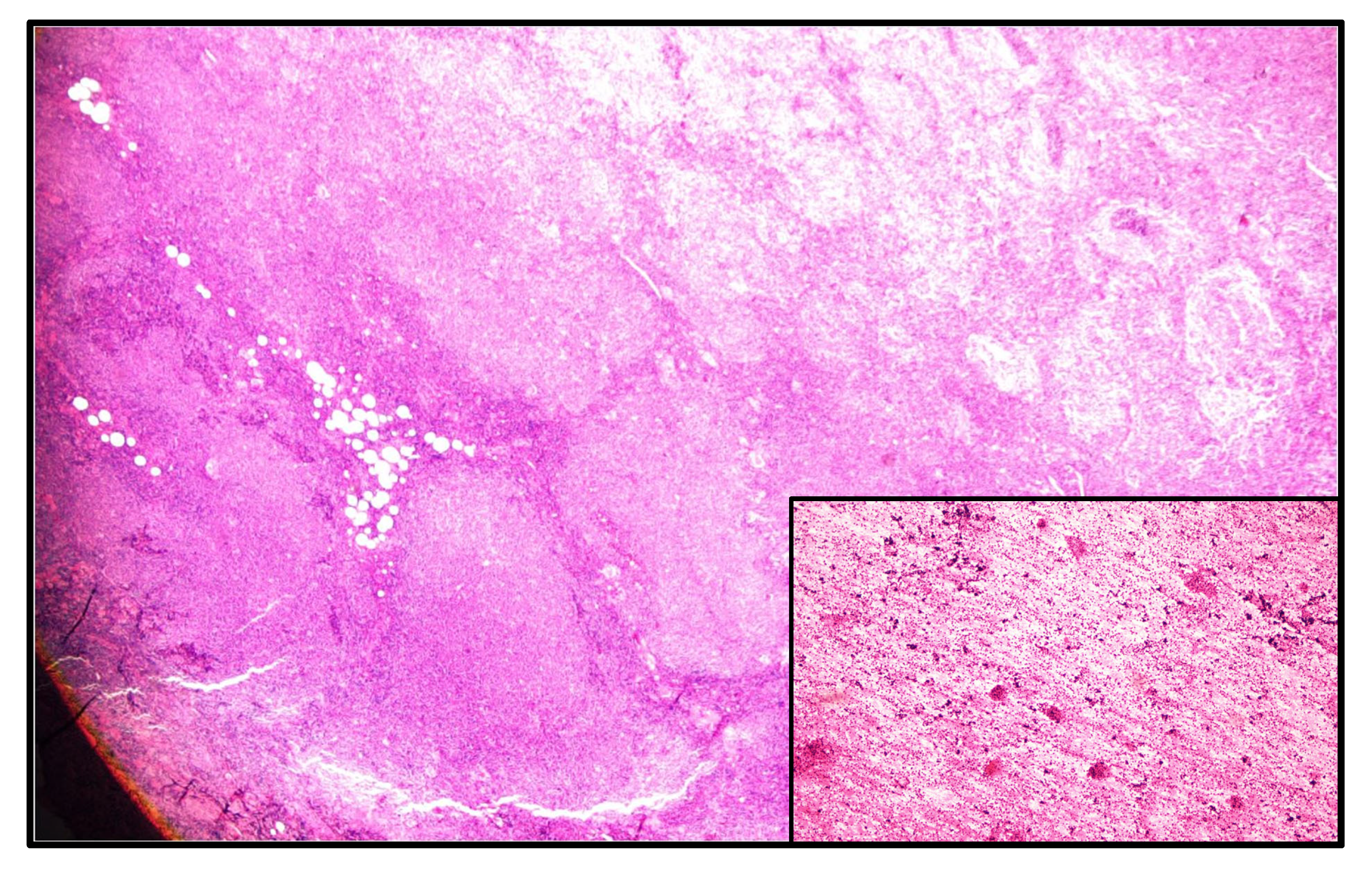 Medicina 60 02086 g004