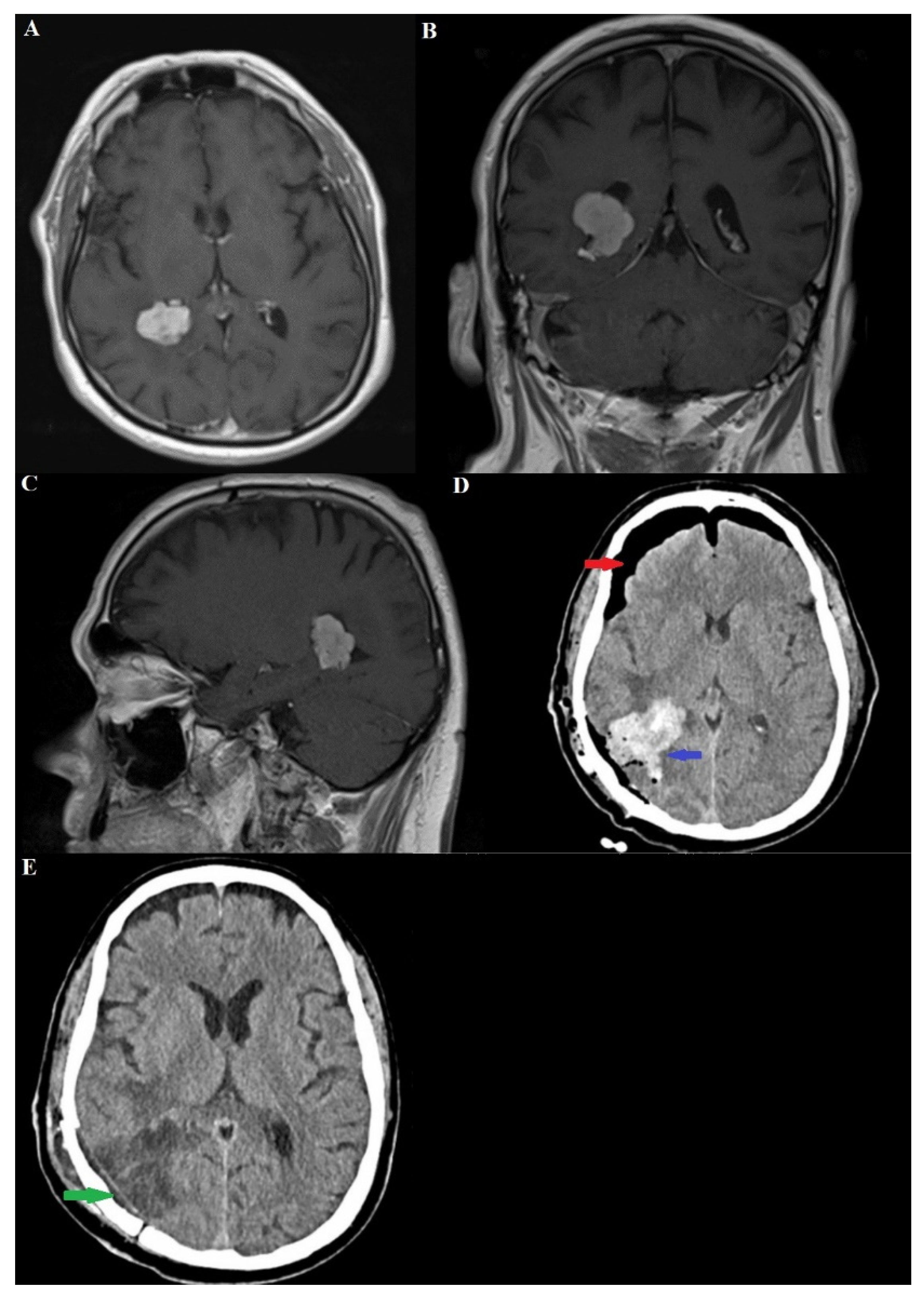 Medicina 60 02100 g001