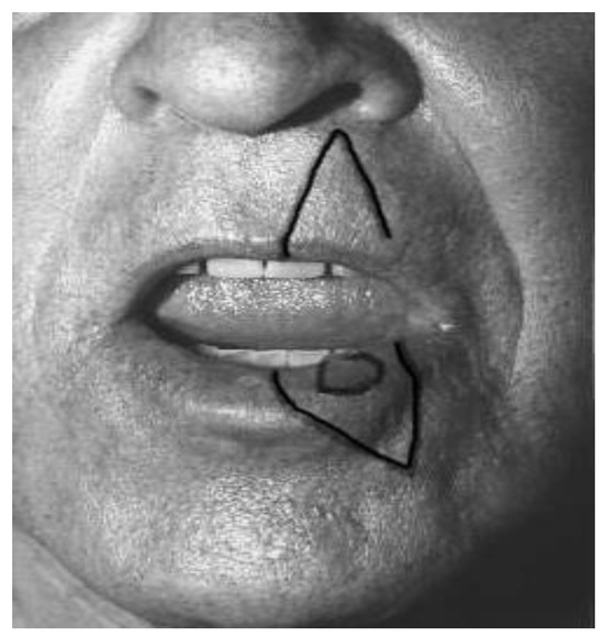 Original Personalized Reconstruction Method for Certain Large 
