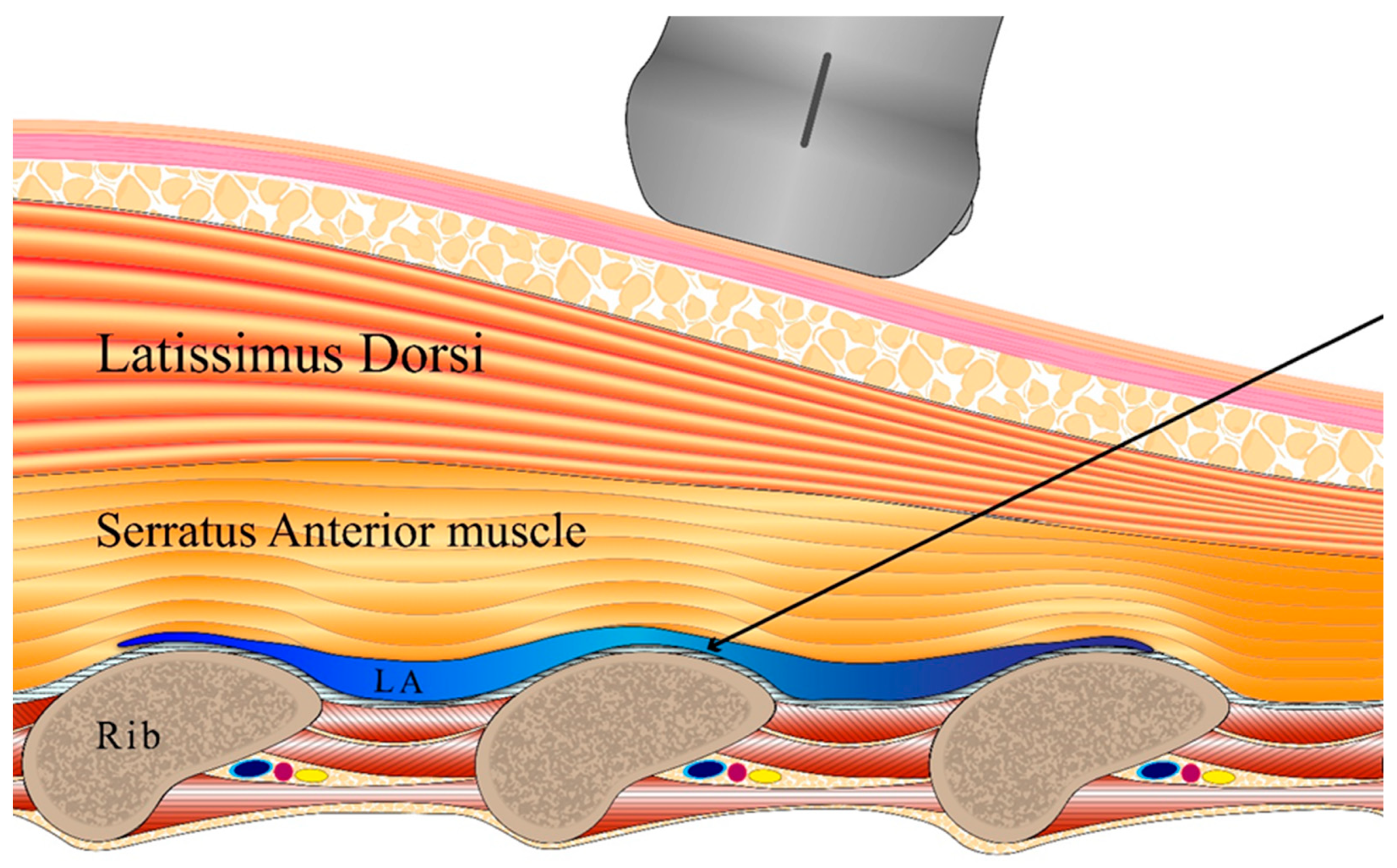 Medicina 61 00011 g001