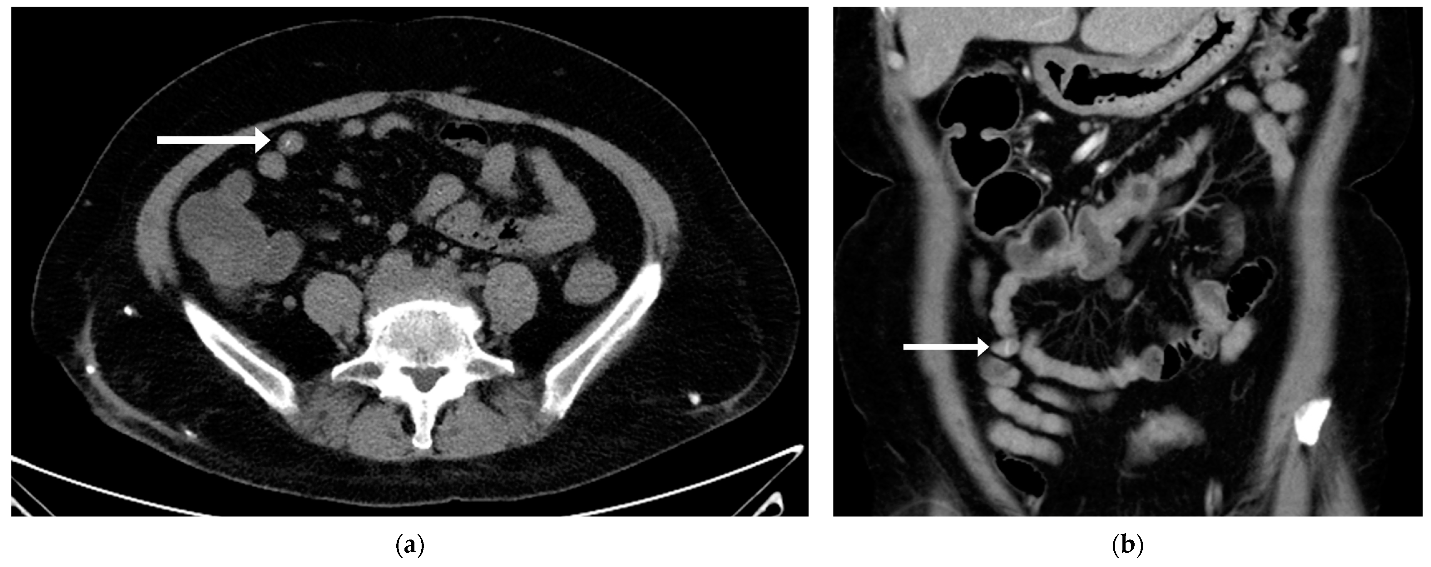 Medicina 61 00030 g002 Medicina 61 00030 g002