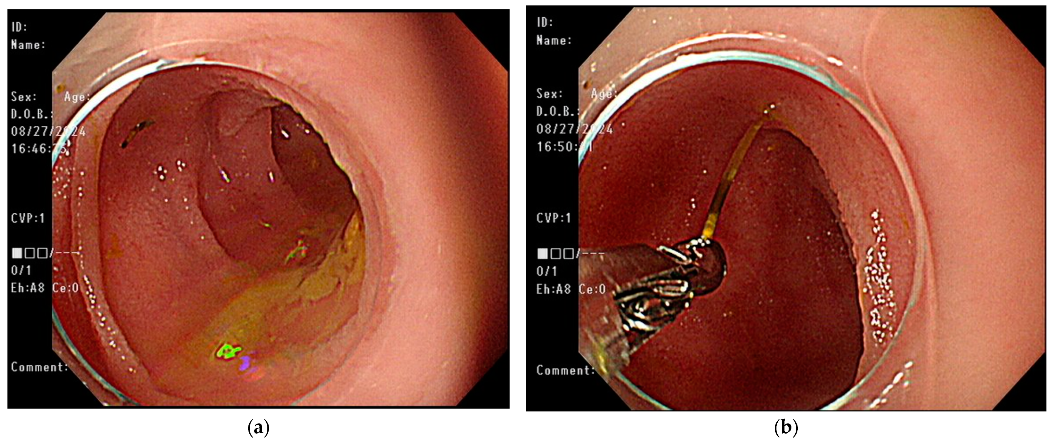 Medicina 61 00030 g003 Medicina 61 00030 g003