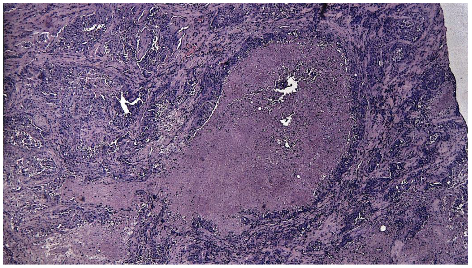 Medicina 61 00037 g006