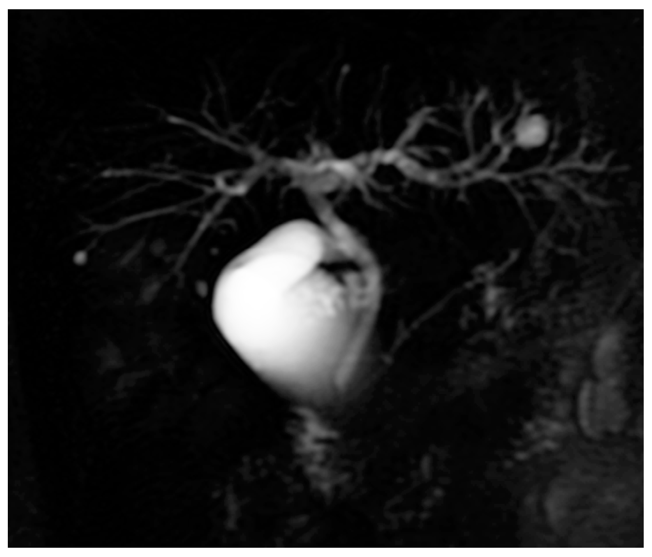 Medicina 61 00044 g001