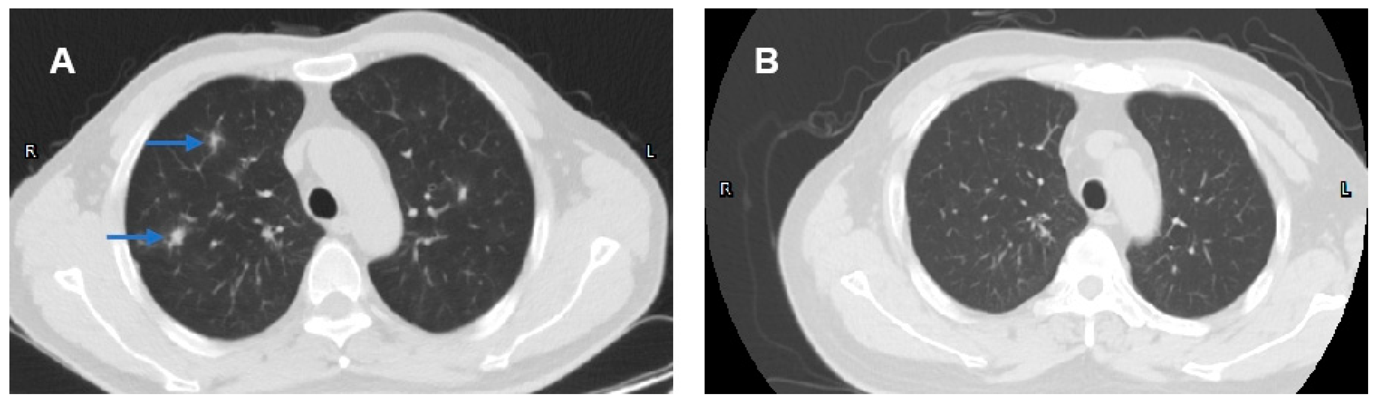 Medicina 61 00044 g002