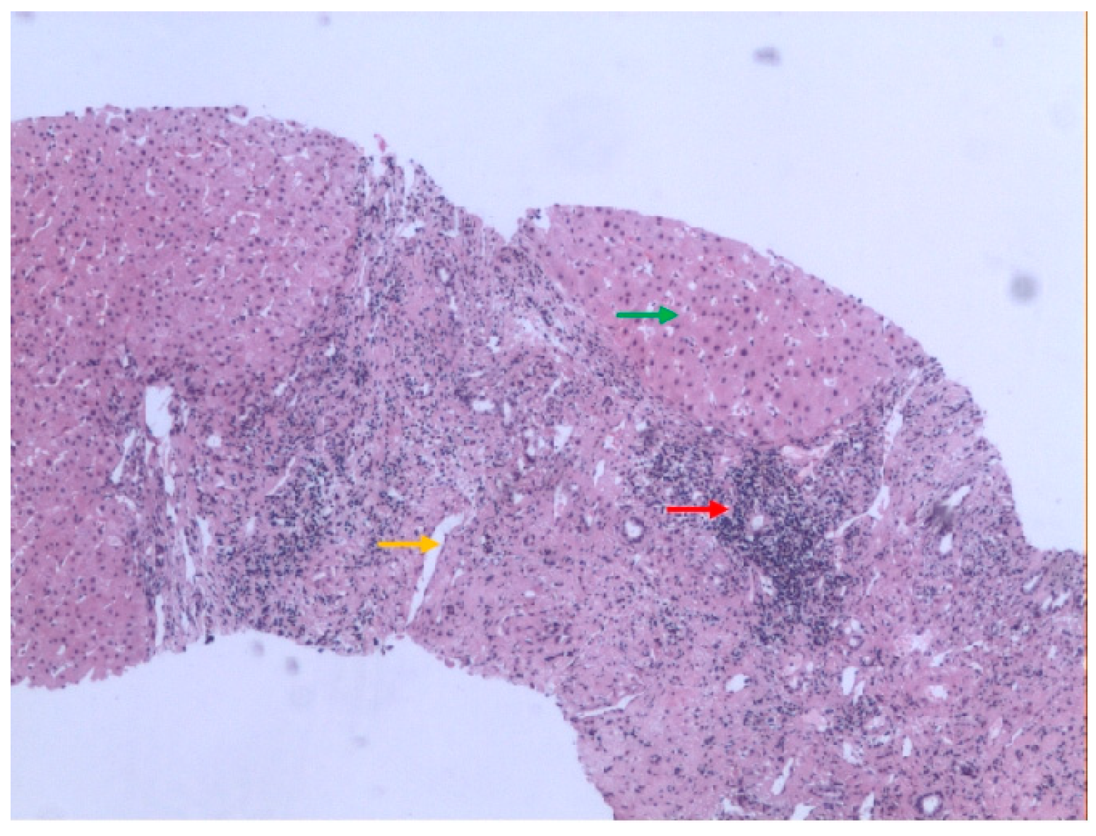 Medicina 61 00044 g003