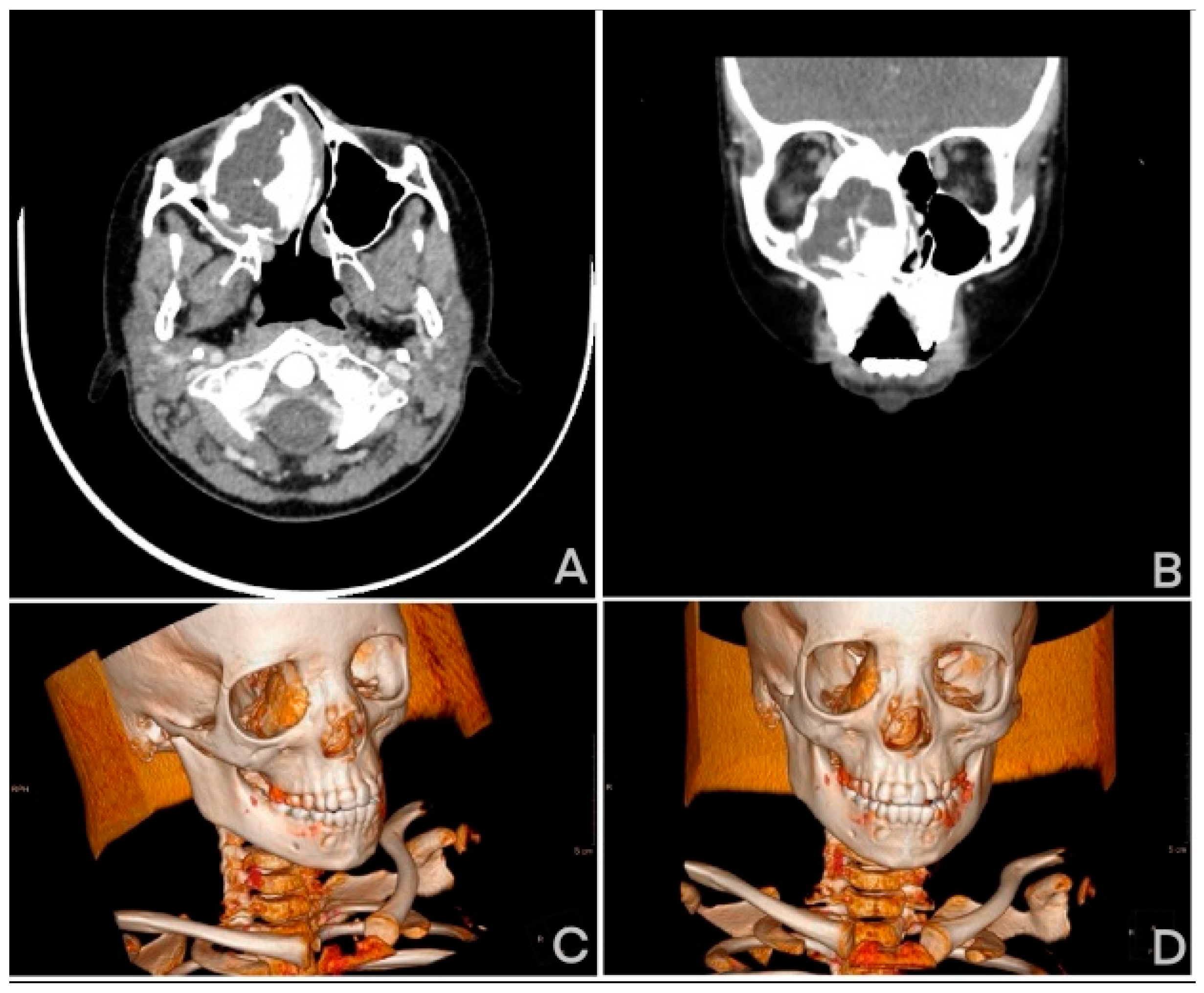 Medicina 61 00045 g004 Medicina 61 00045 g004