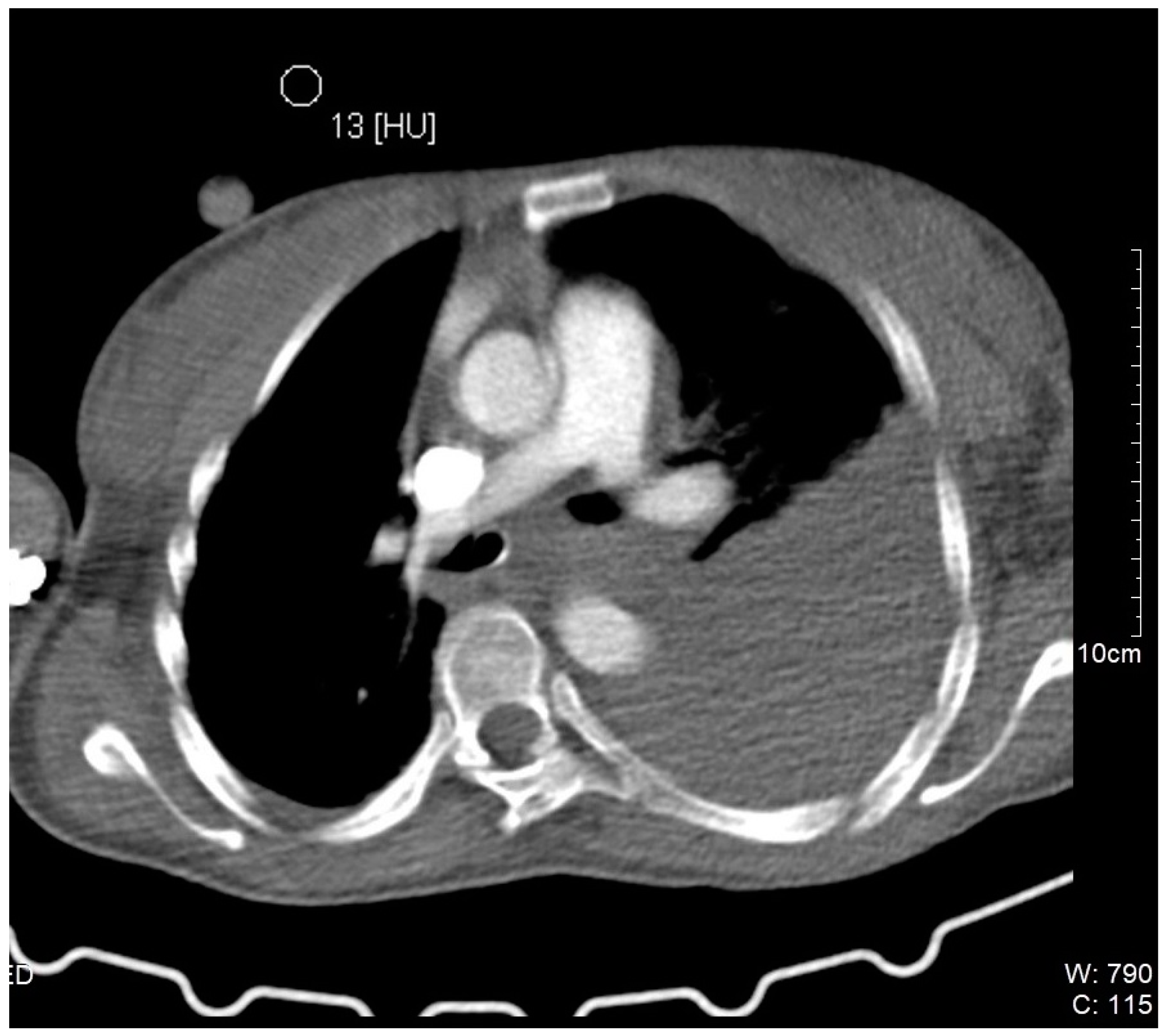 Medicina 61 00049 g002