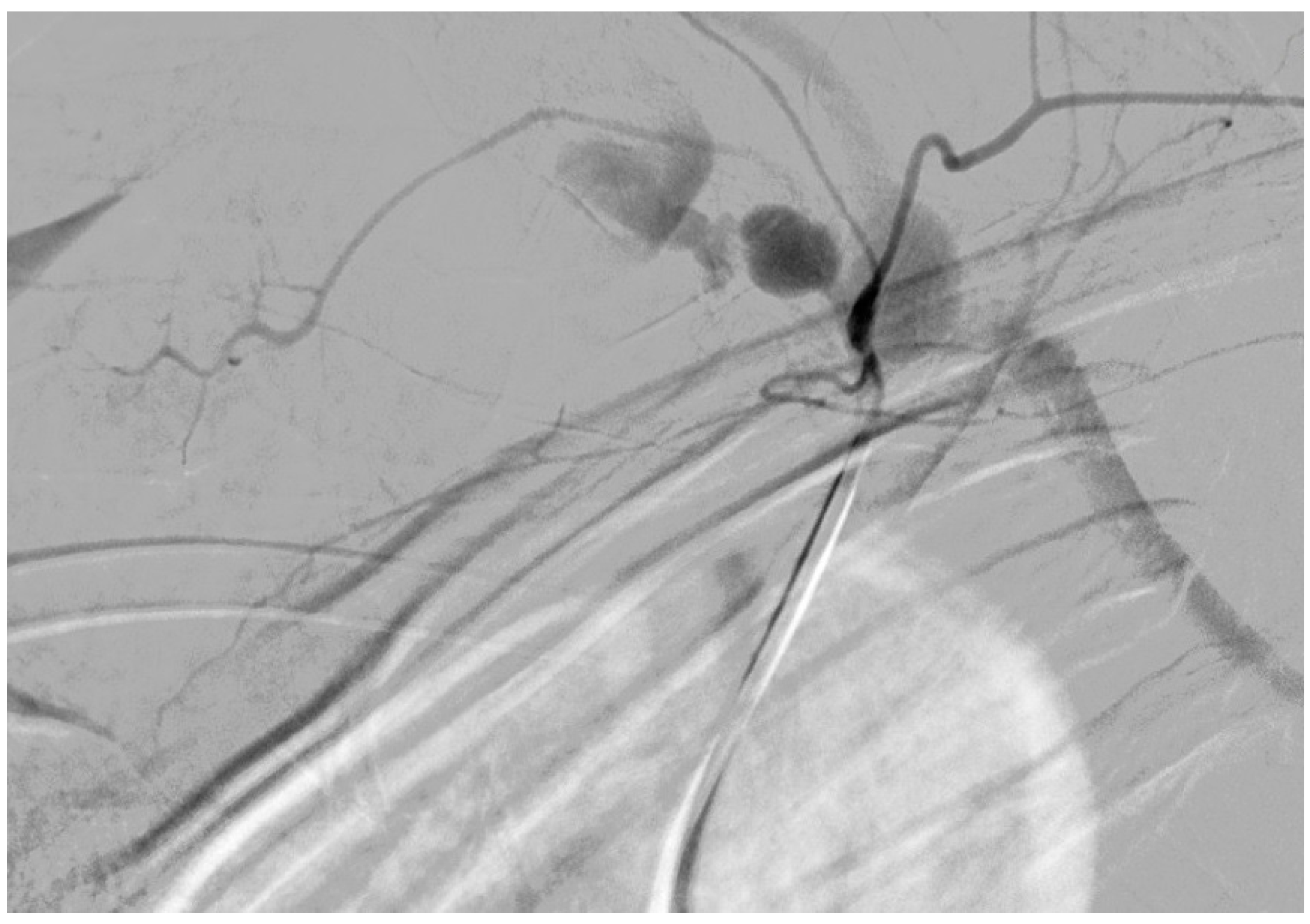 Medicina 61 00049 g004