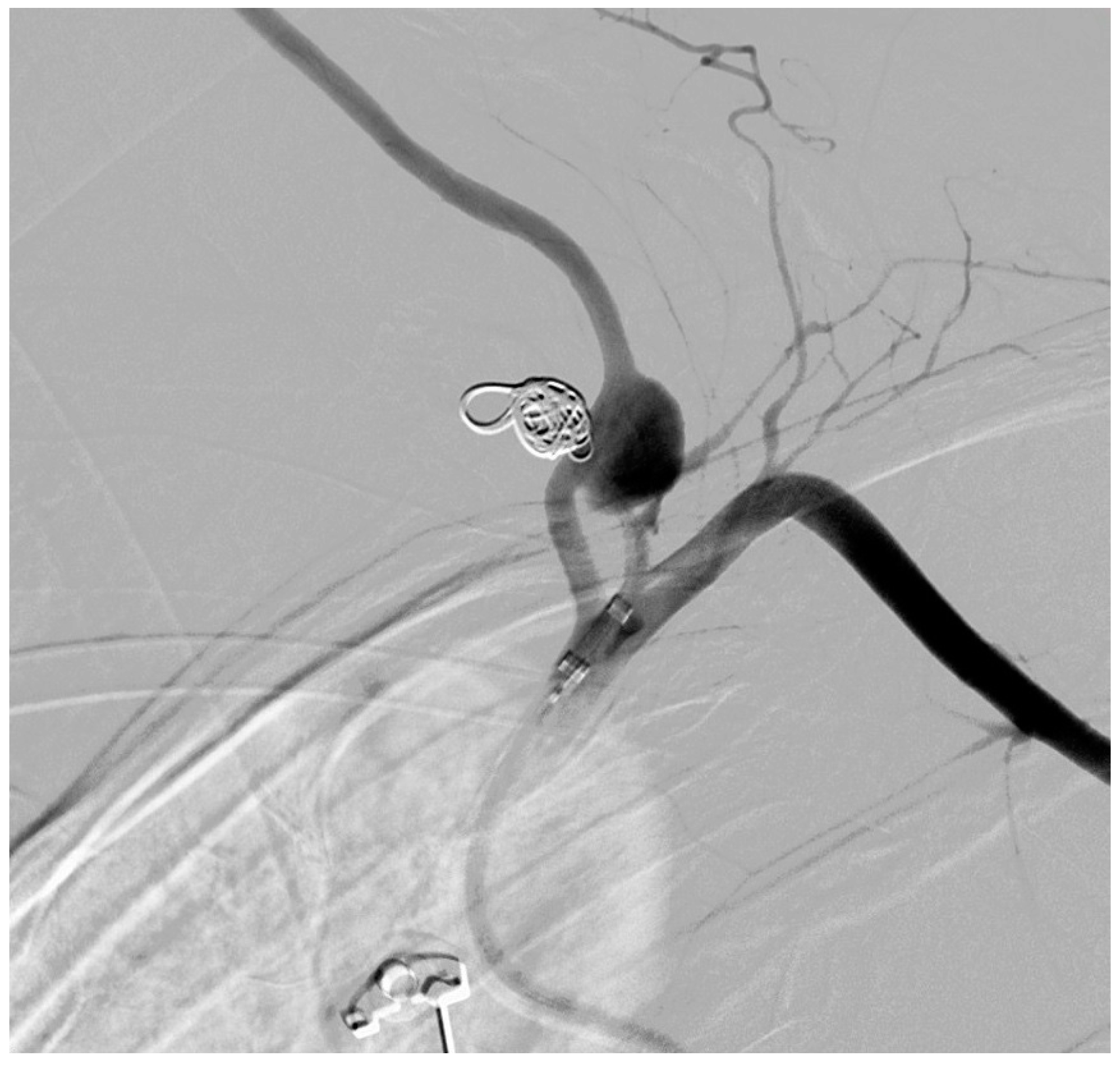 Medicina 61 00049 g005