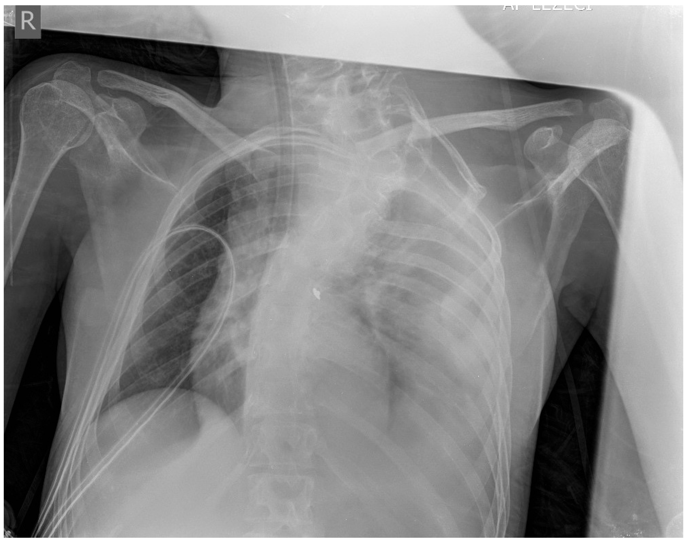 Medicina 61 00049 g006