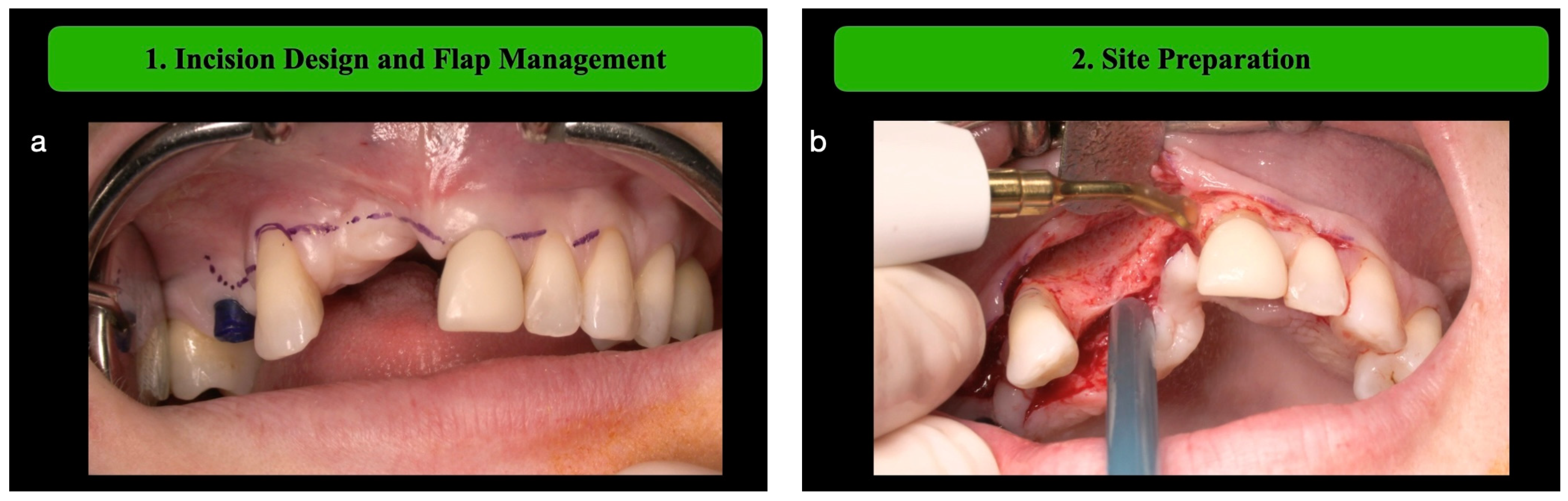 Medicina 61 00058 g001