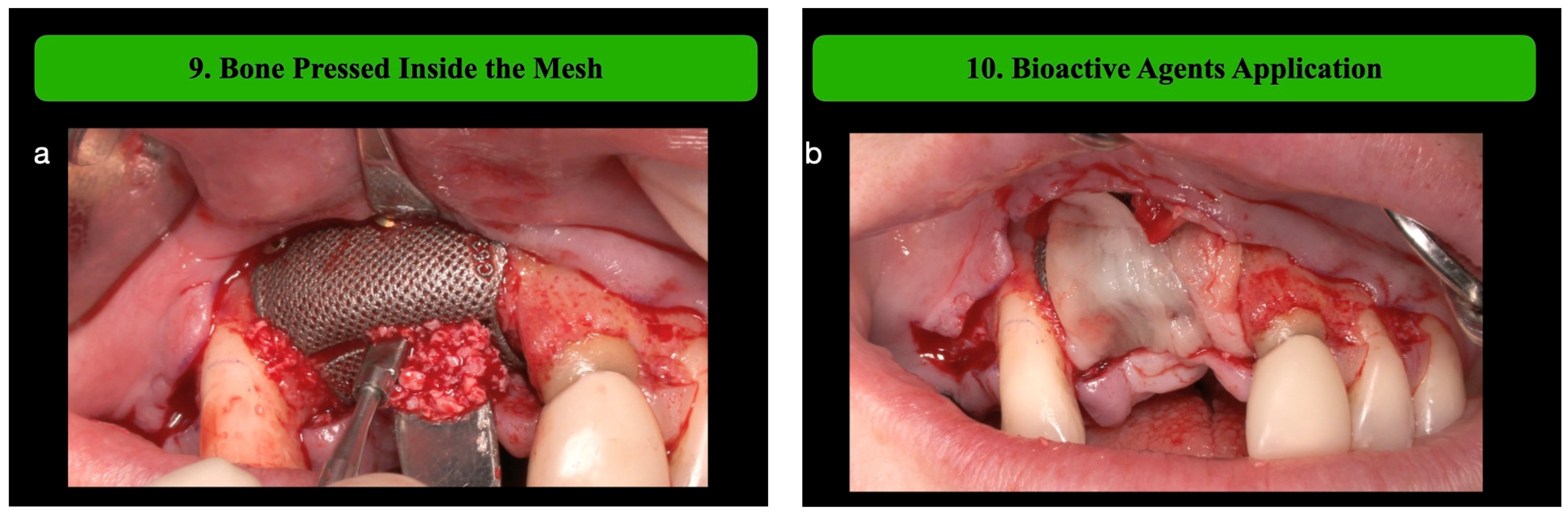 Medicina 61 00058 g004