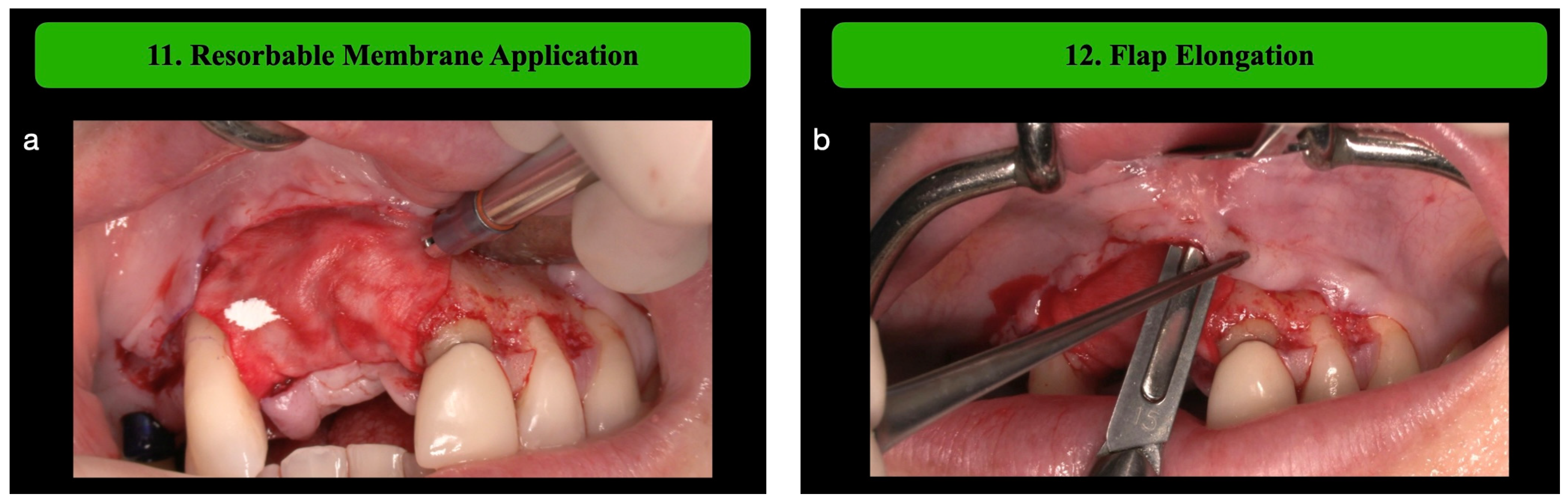 Medicina 61 00058 g005a