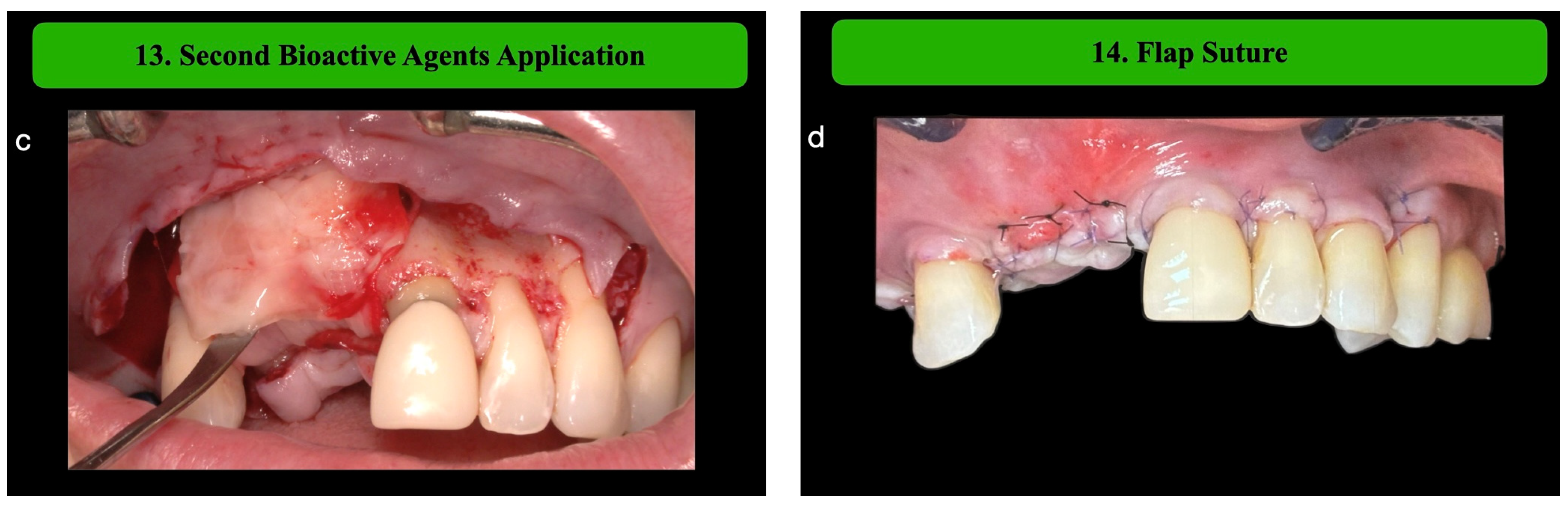 Medicina 61 00058 g005b