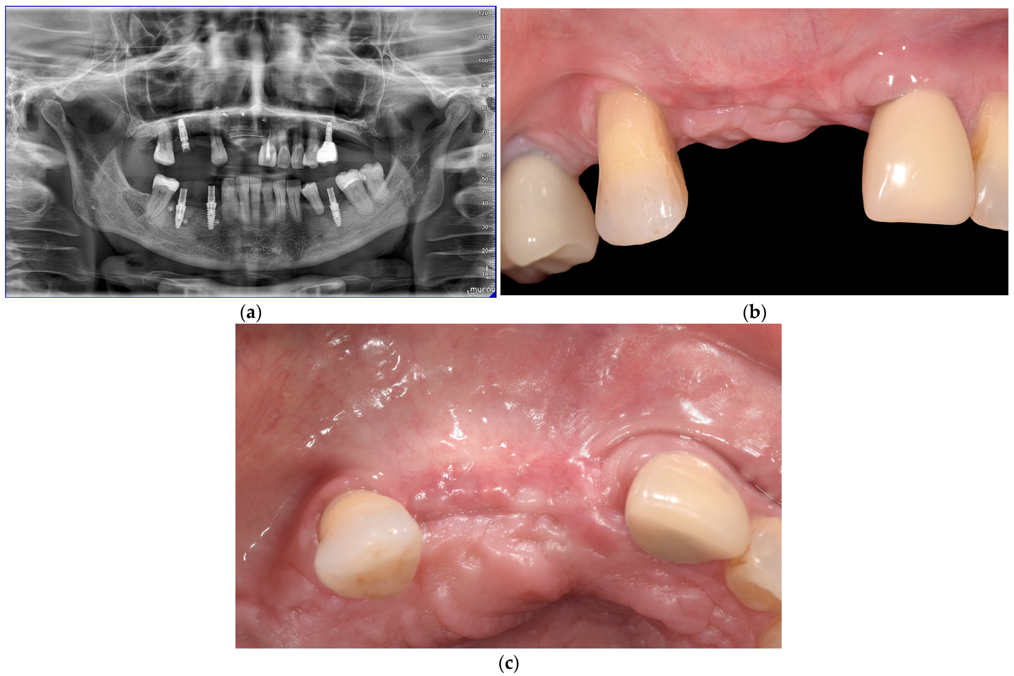 Medicina 61 00058 g006