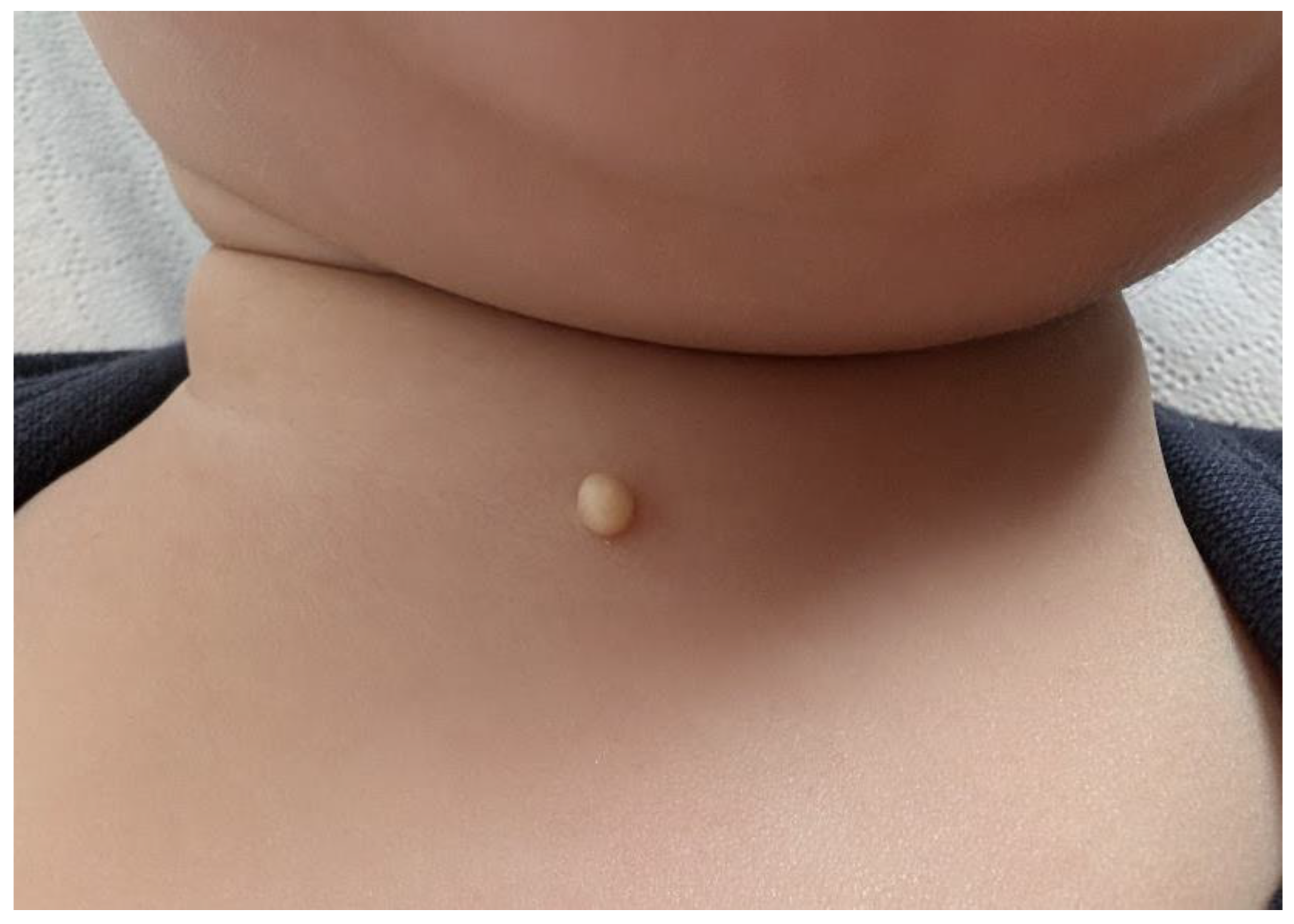 Medicina 61 00064 g001