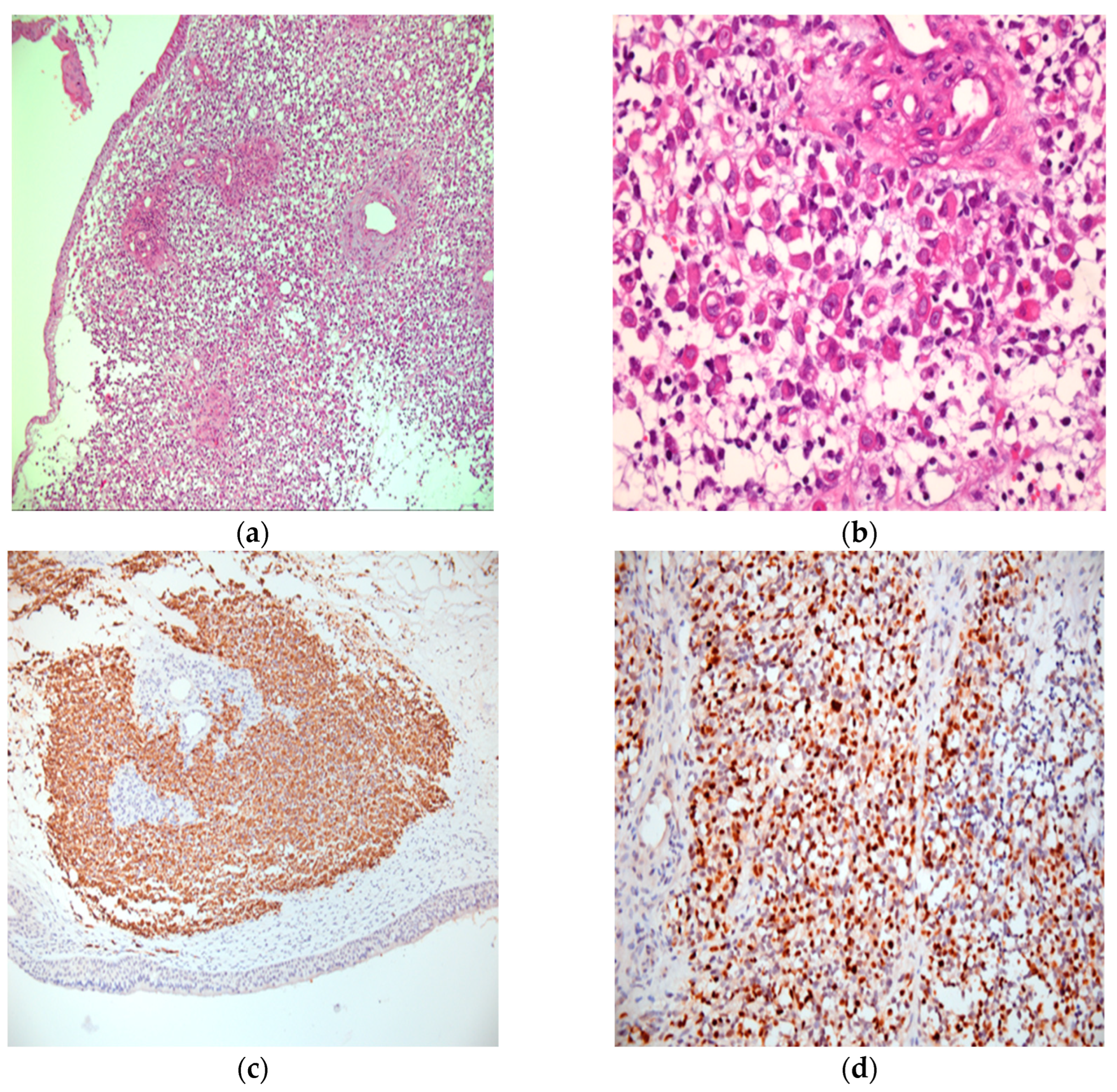 Medicina 61 00080 g001