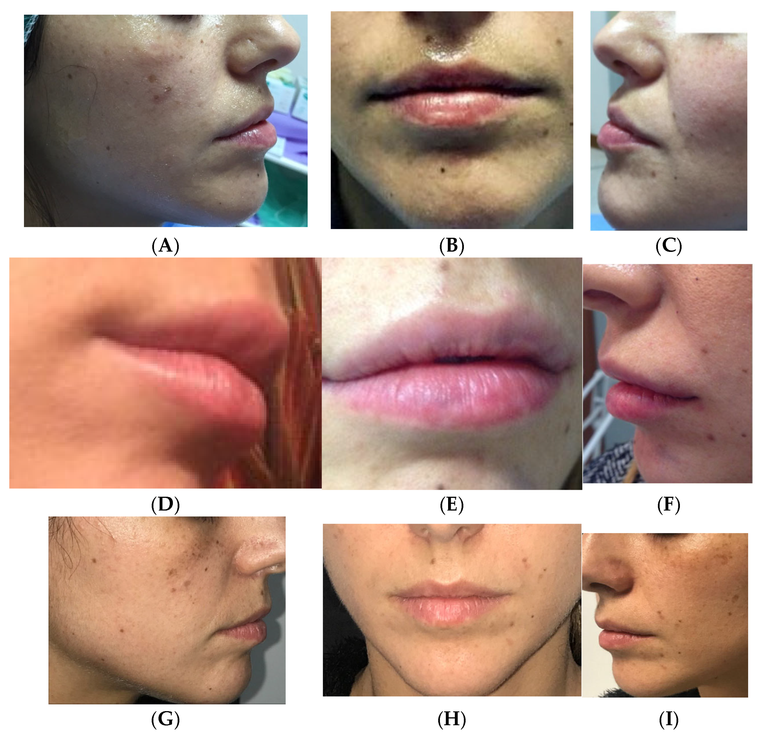 Medicina 61 00084 g004