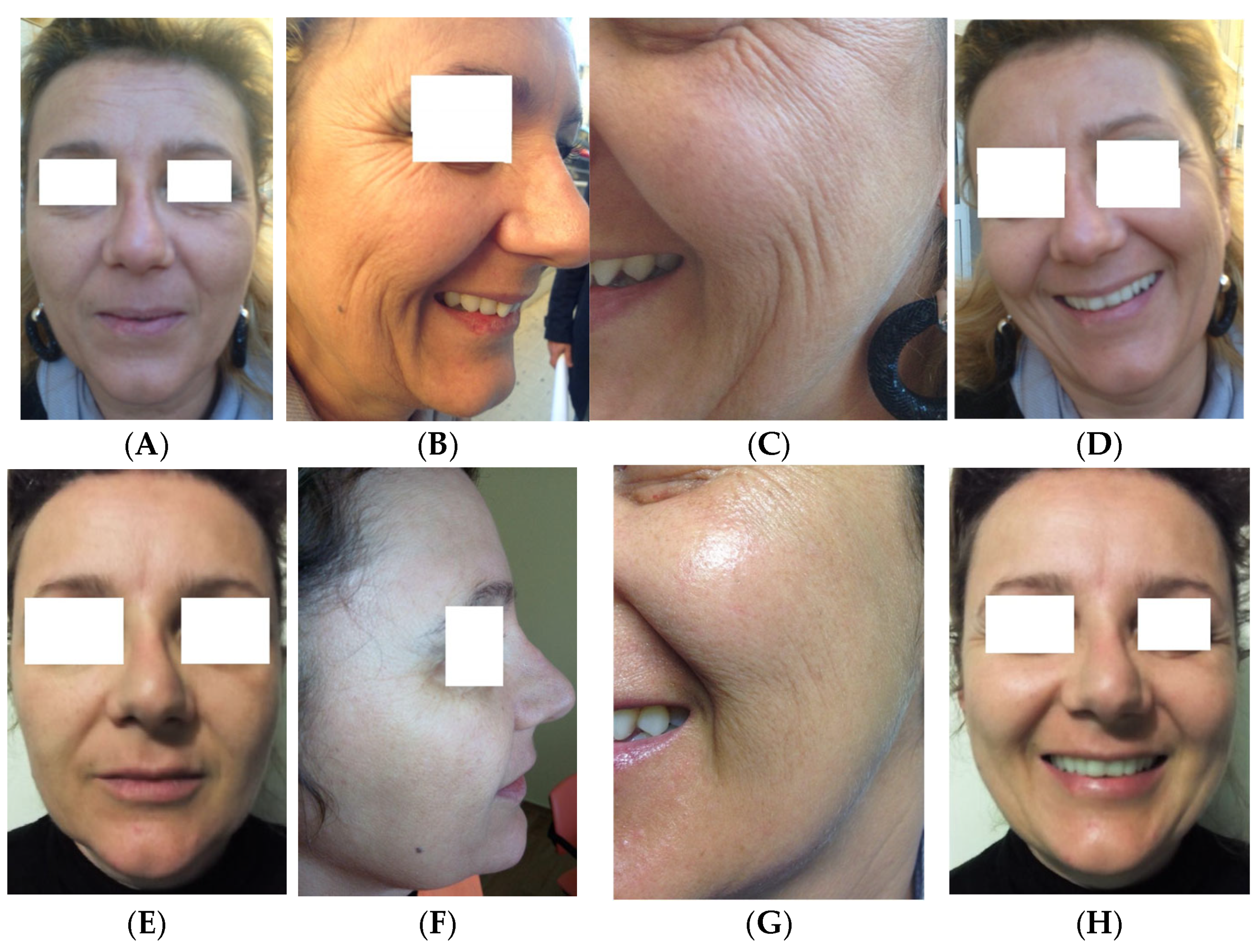 Medicina 61 00084 g005