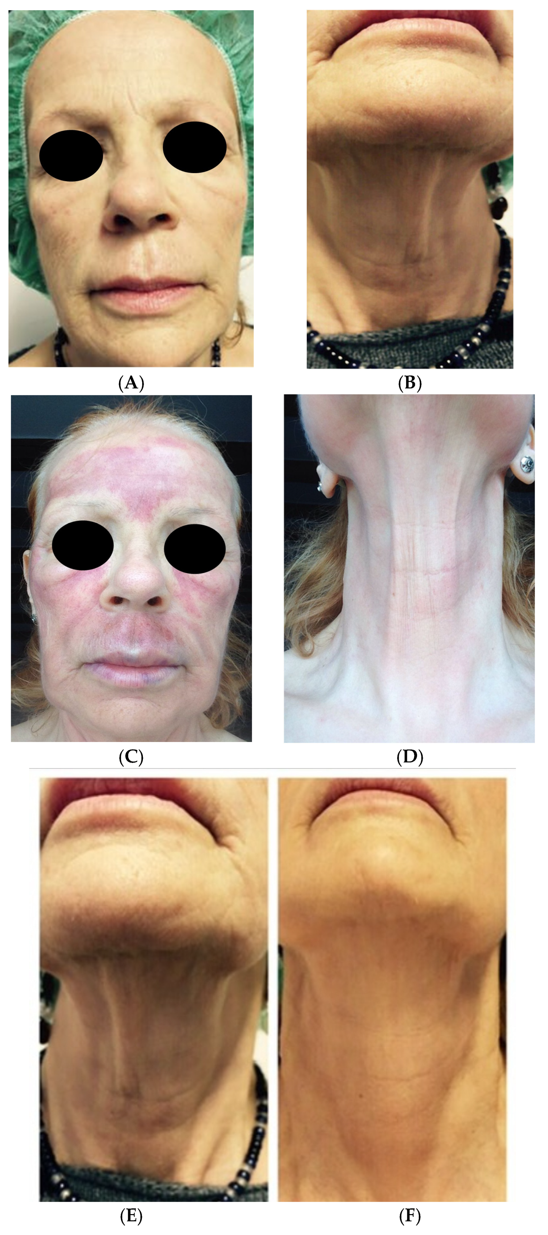 Medicina 61 00084 g006a