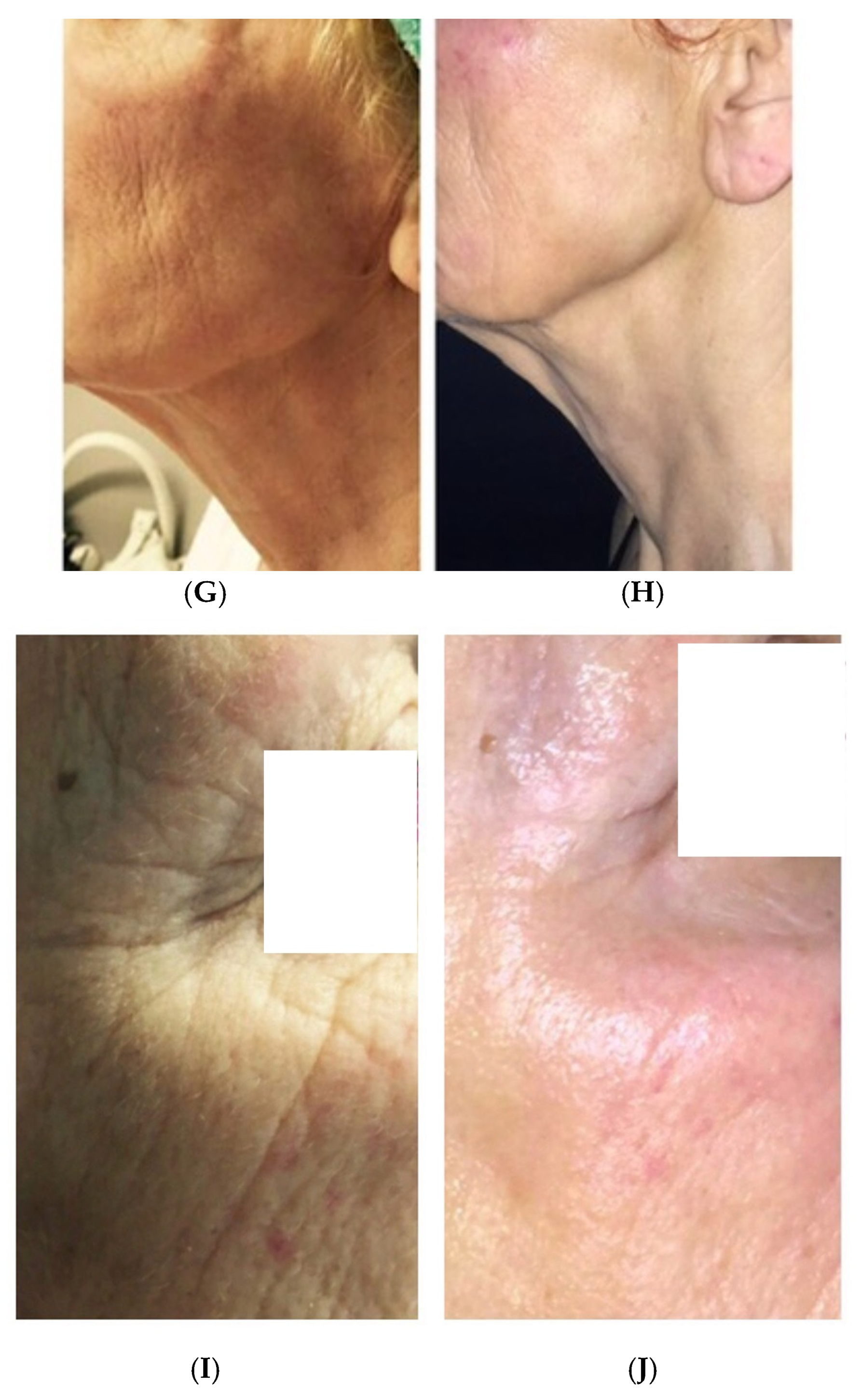 Medicina 61 00084 g006b