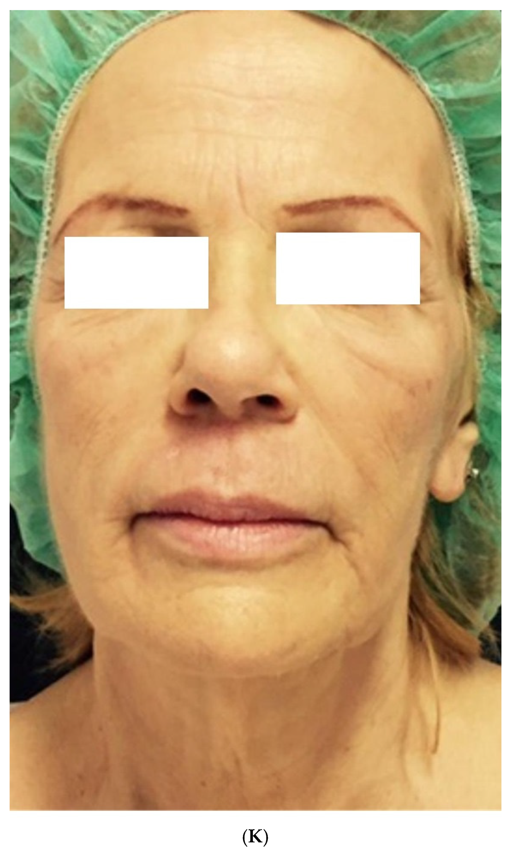 Medicina 61 00084 g006c