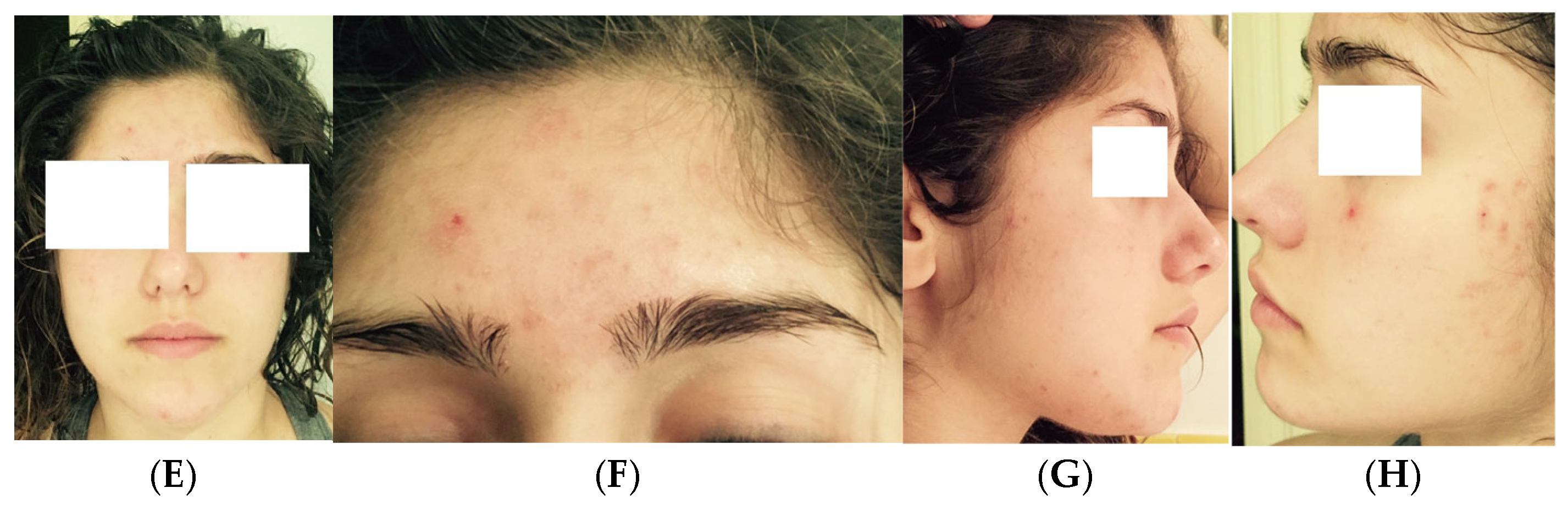 Medicina 61 00084 g007b