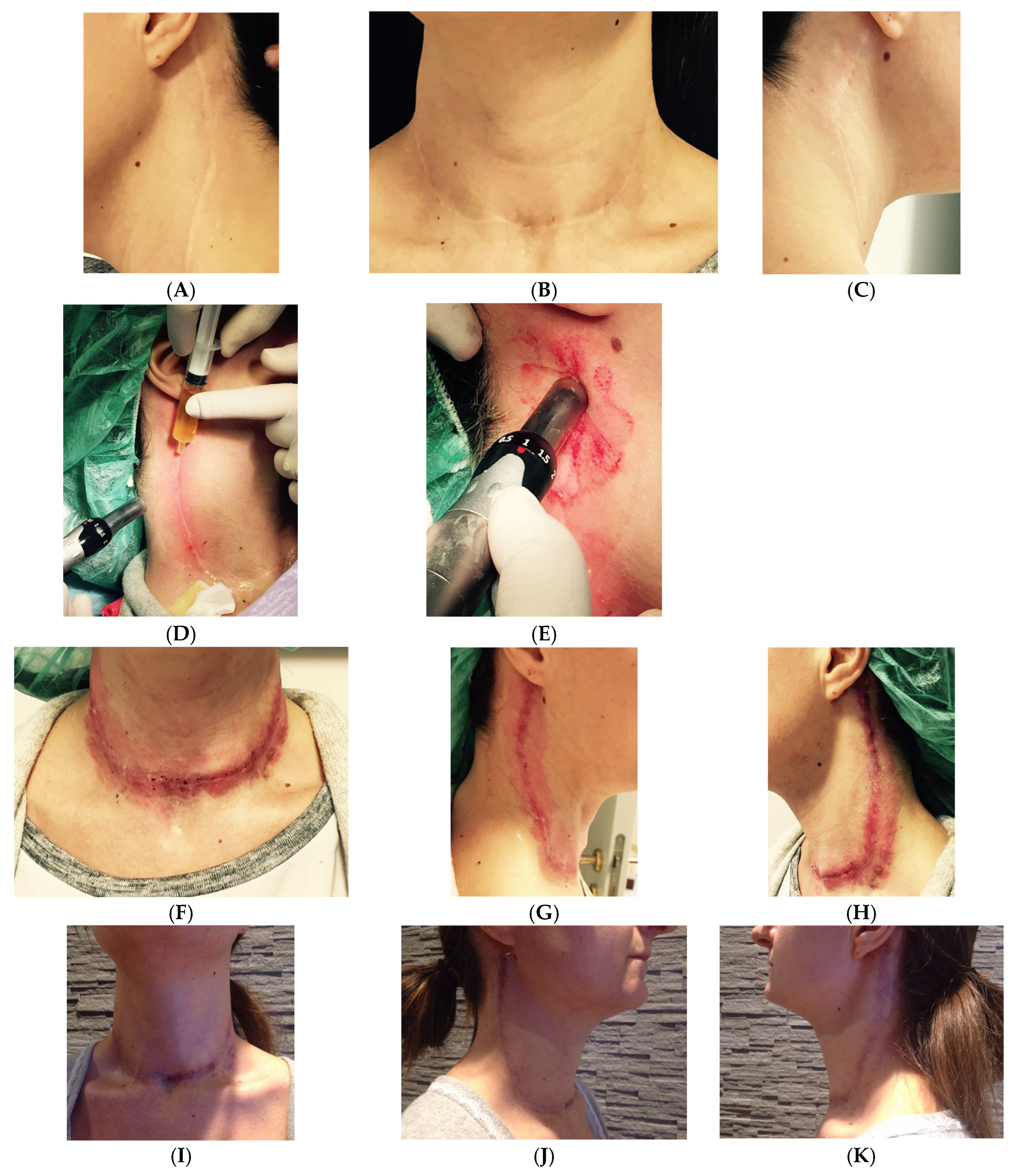 Medicina 61 00084 g008a