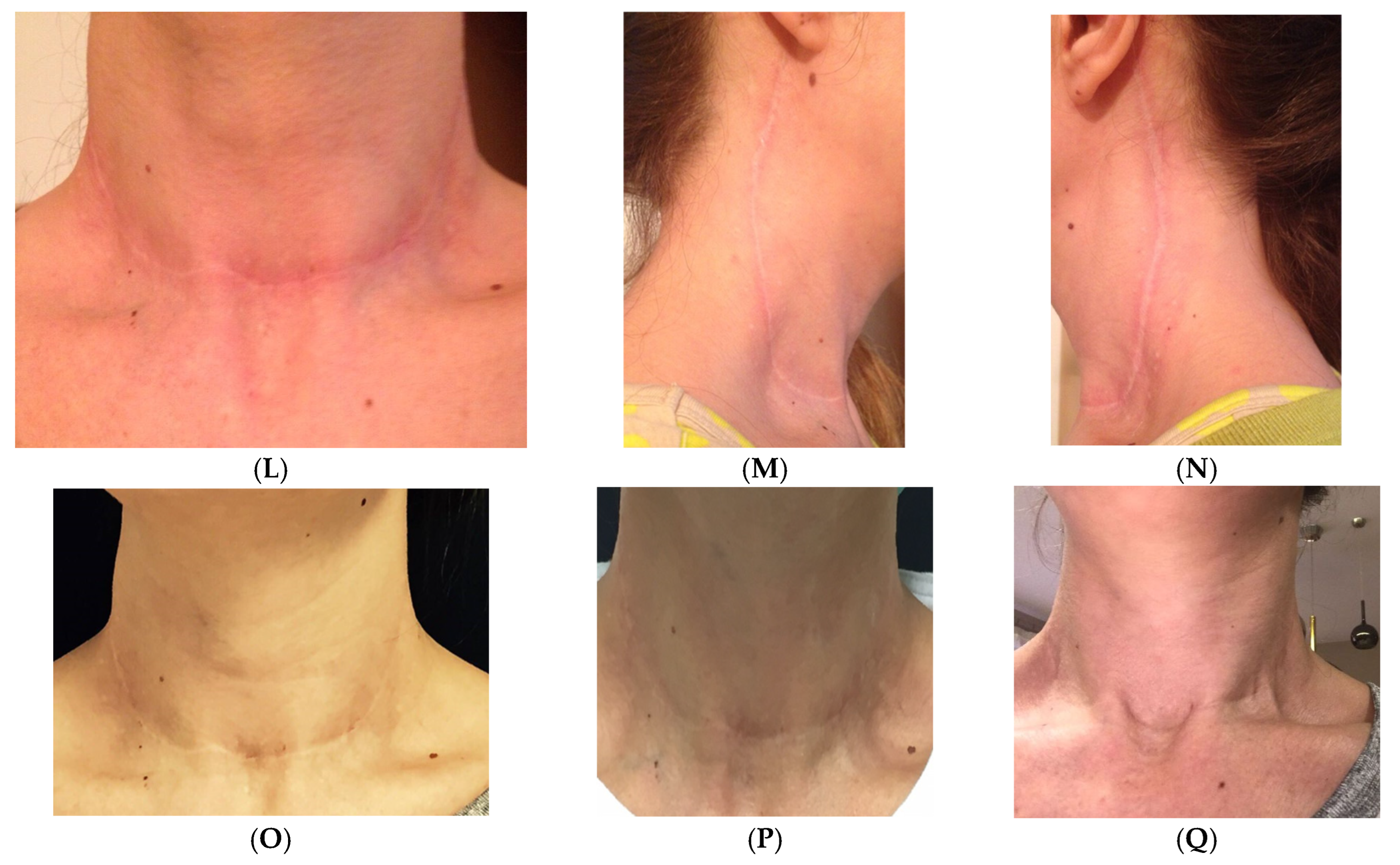 Medicina 61 00084 g008b