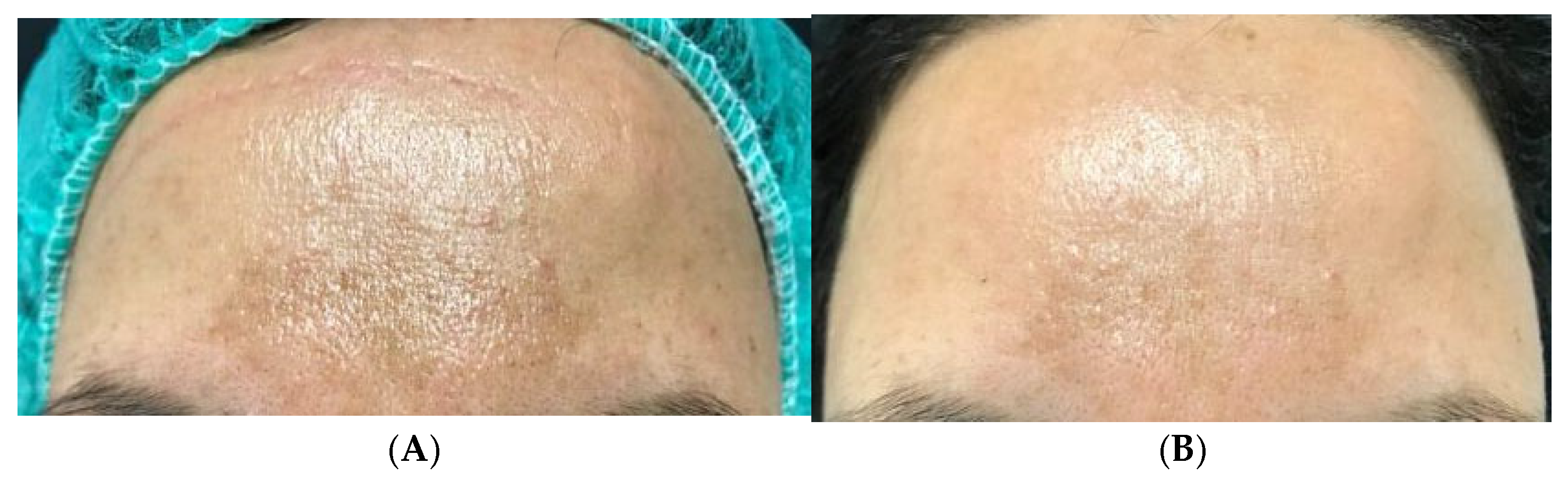 Medicina 61 00084 g009a