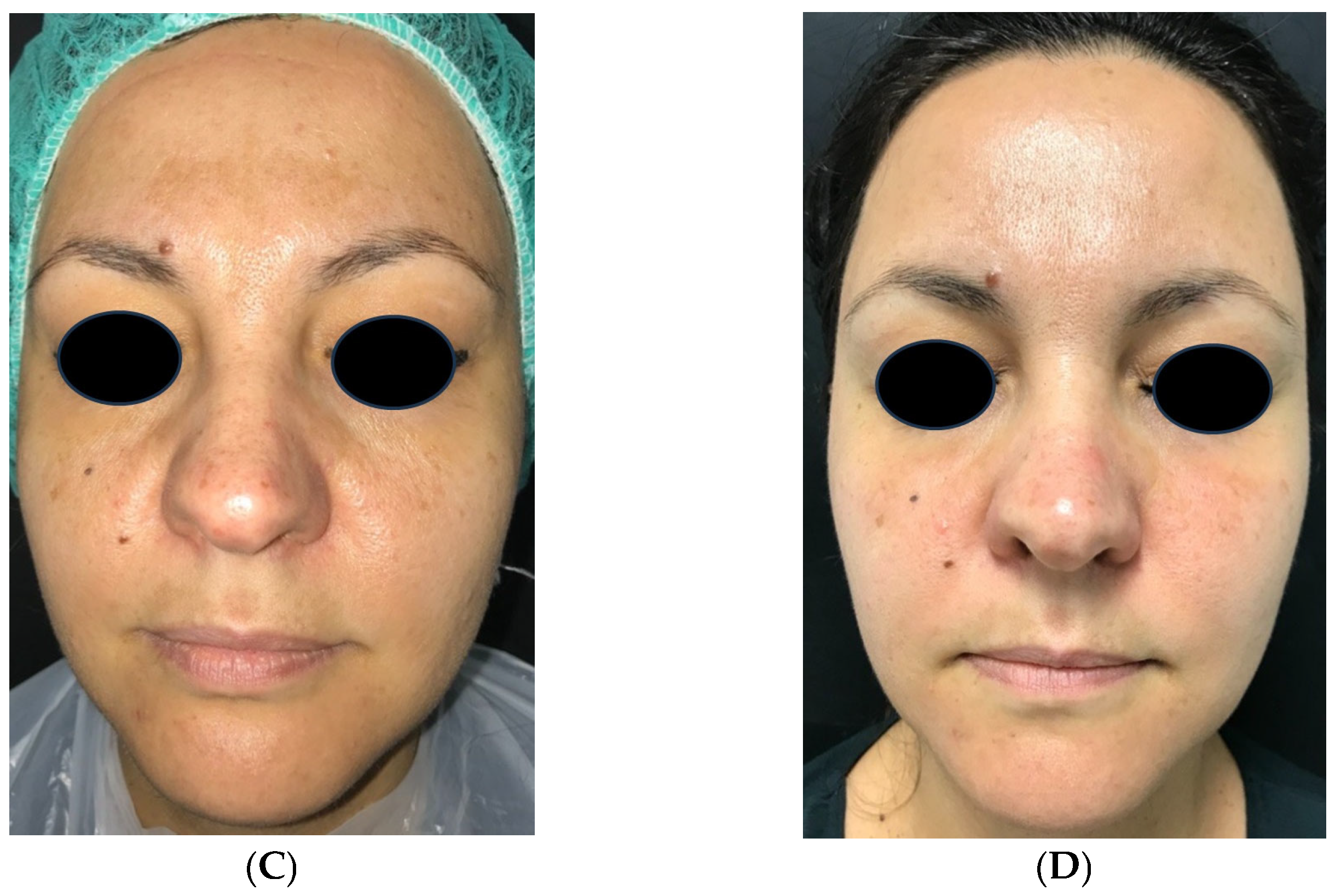 Medicina 61 00084 g009b