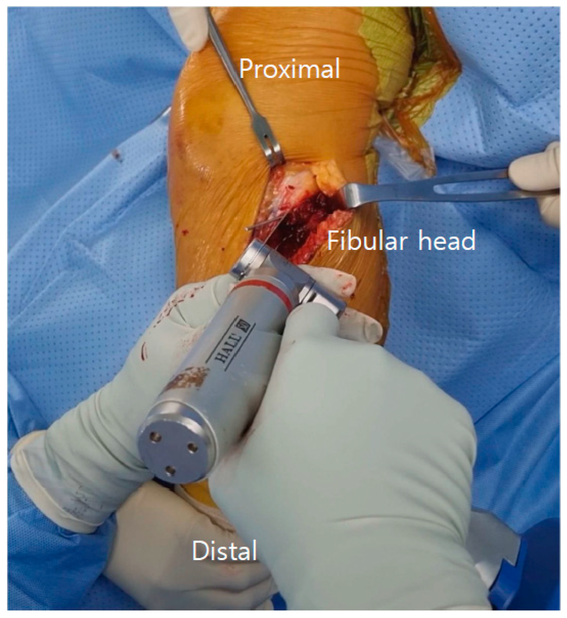 Medicina 61 00091 g001