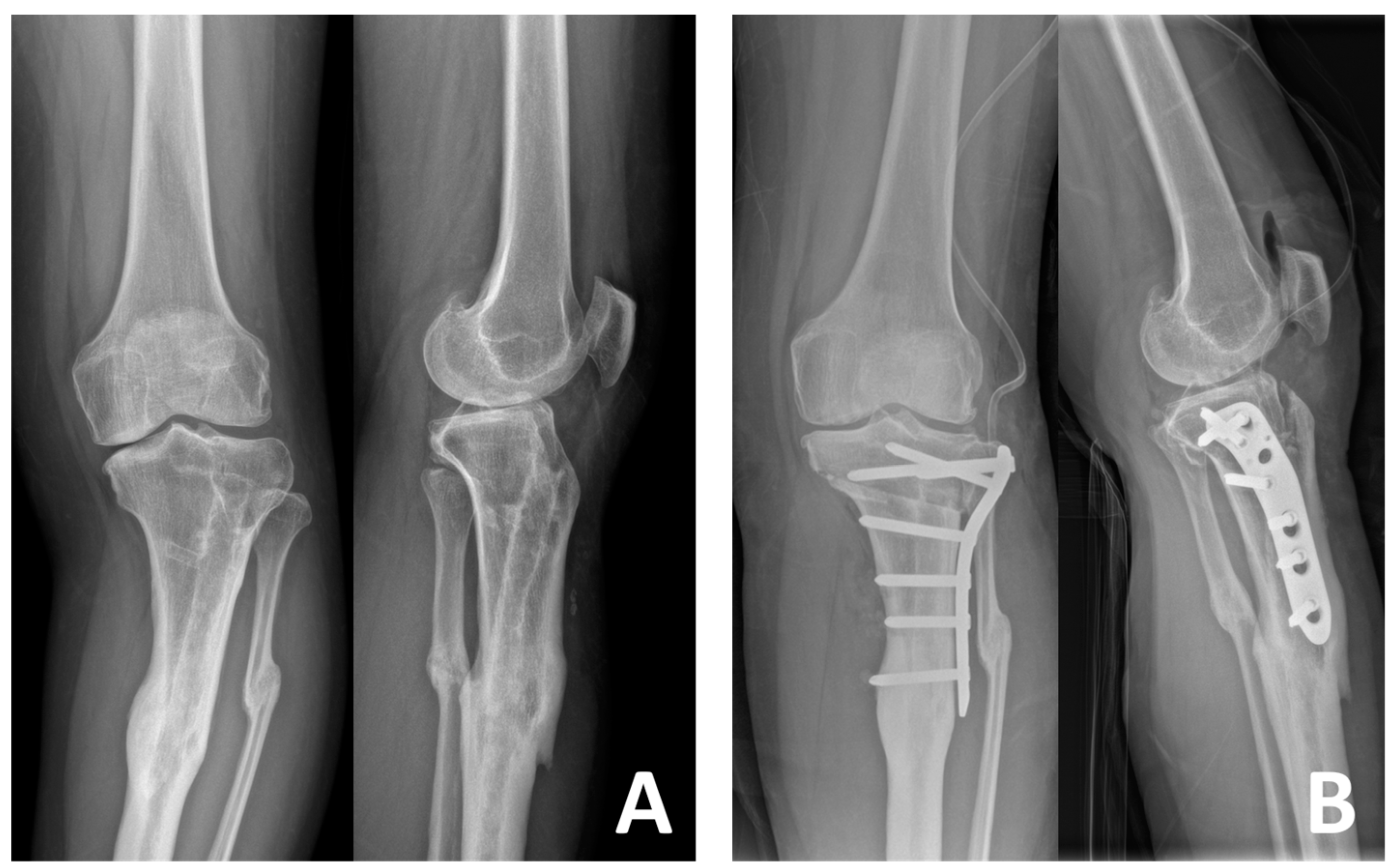 Medicina 61 00091 g003