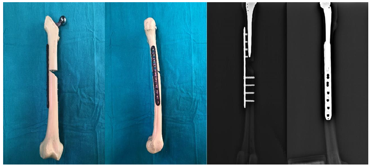 Medicina 61 00110 g002