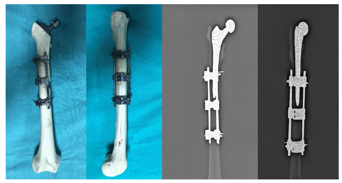 Medicina 61 00110 g004