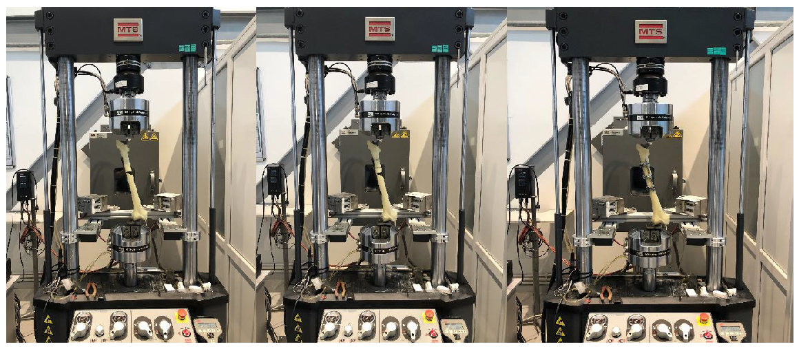 Medicina 61 00110 g005