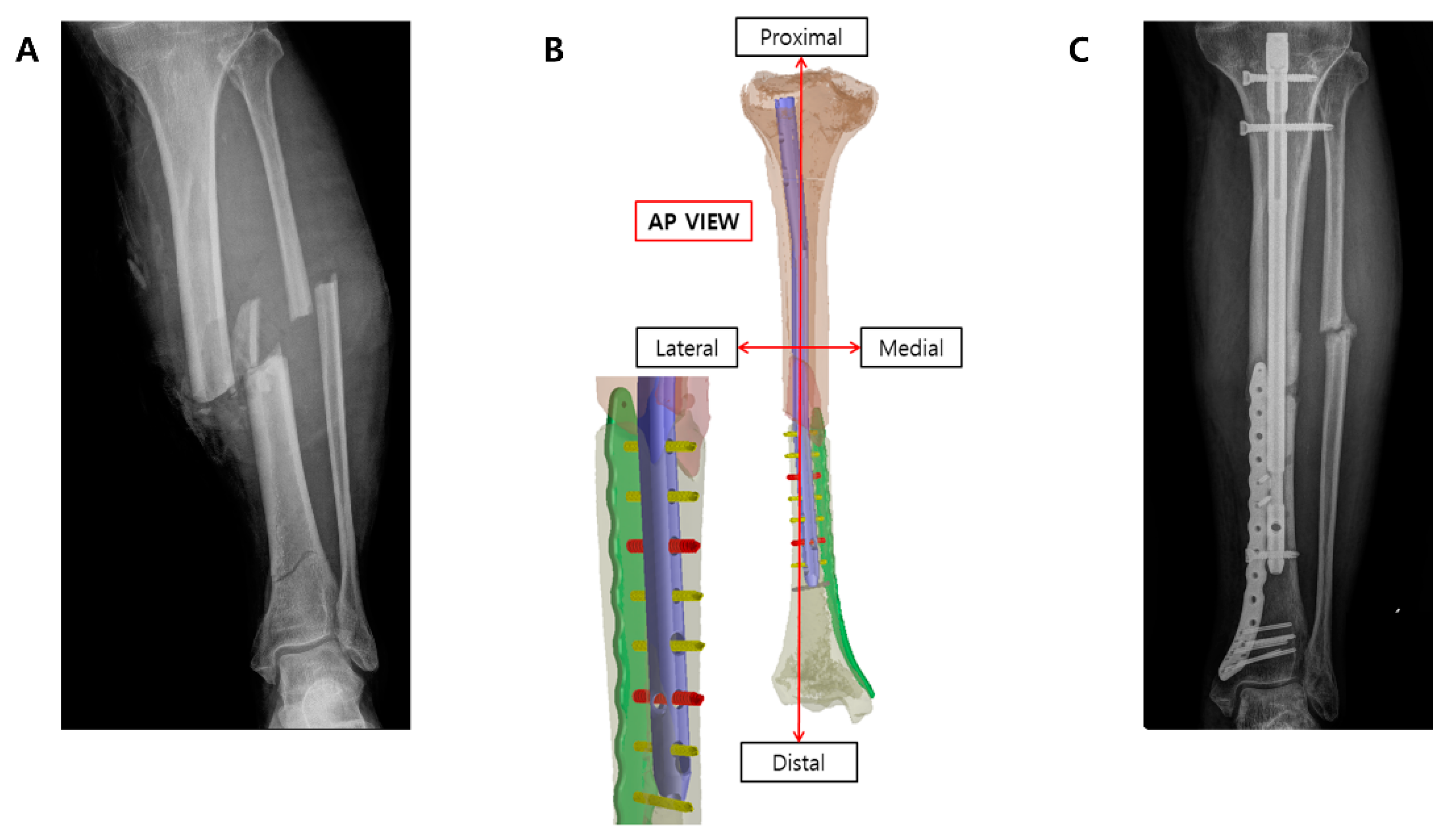Medicina 61 00137 g005