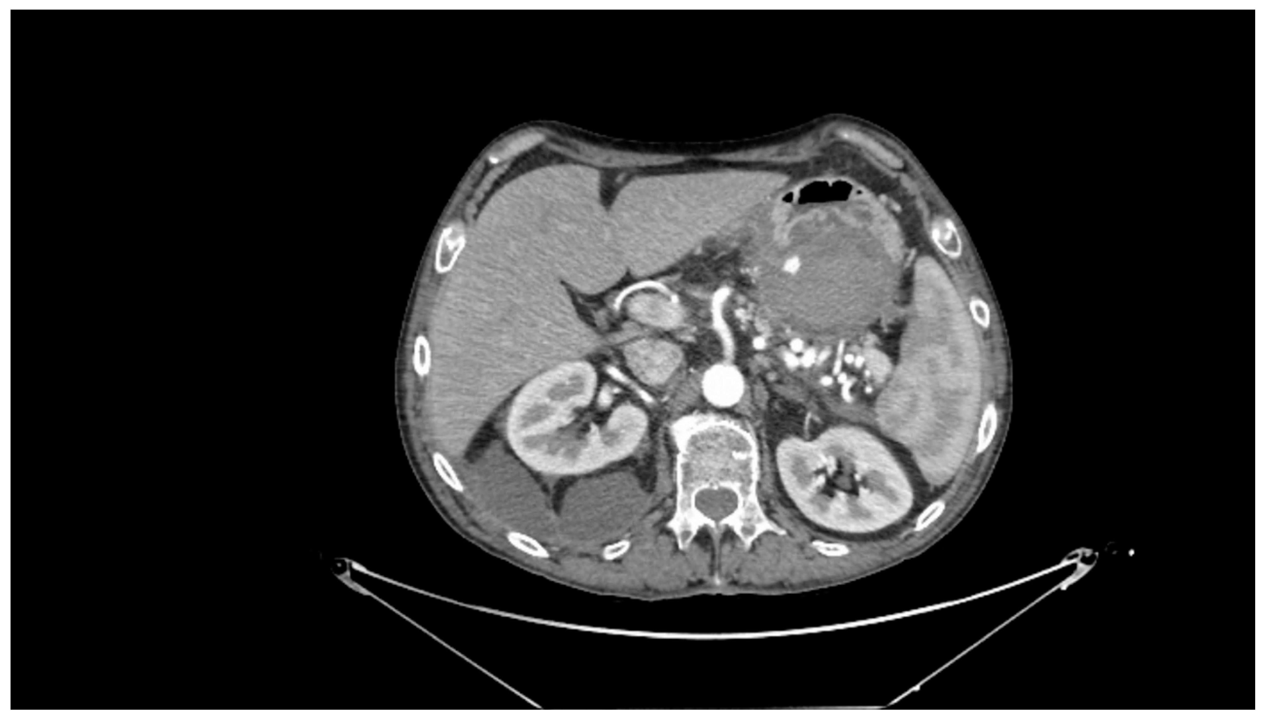 Medicina 61 00164 g002