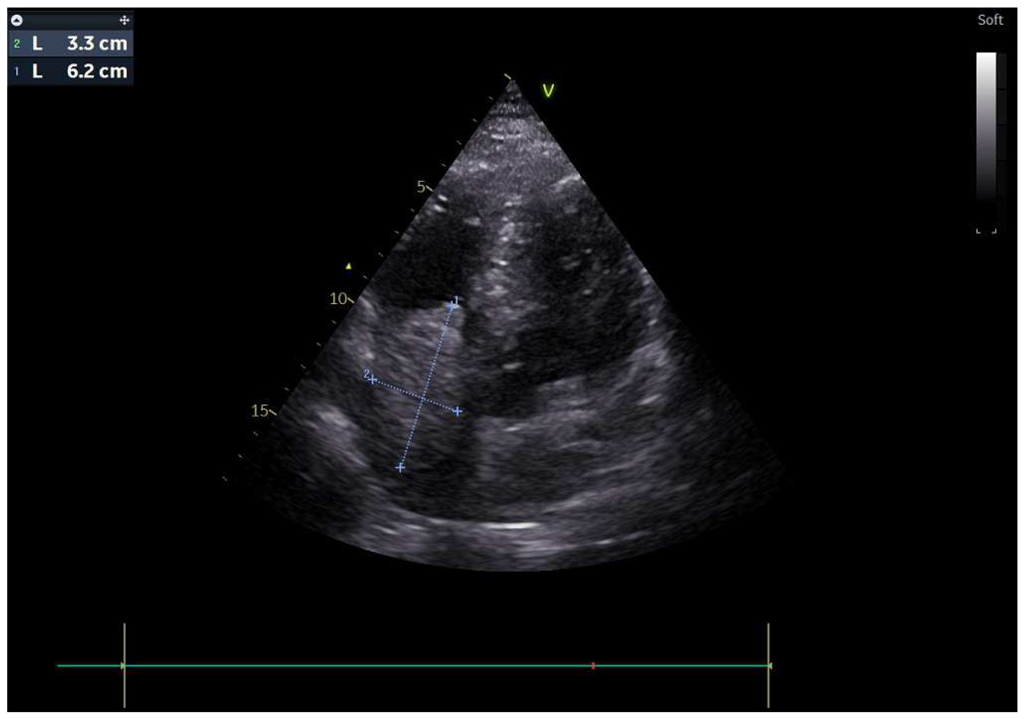 Medicina 61 00170 g001
