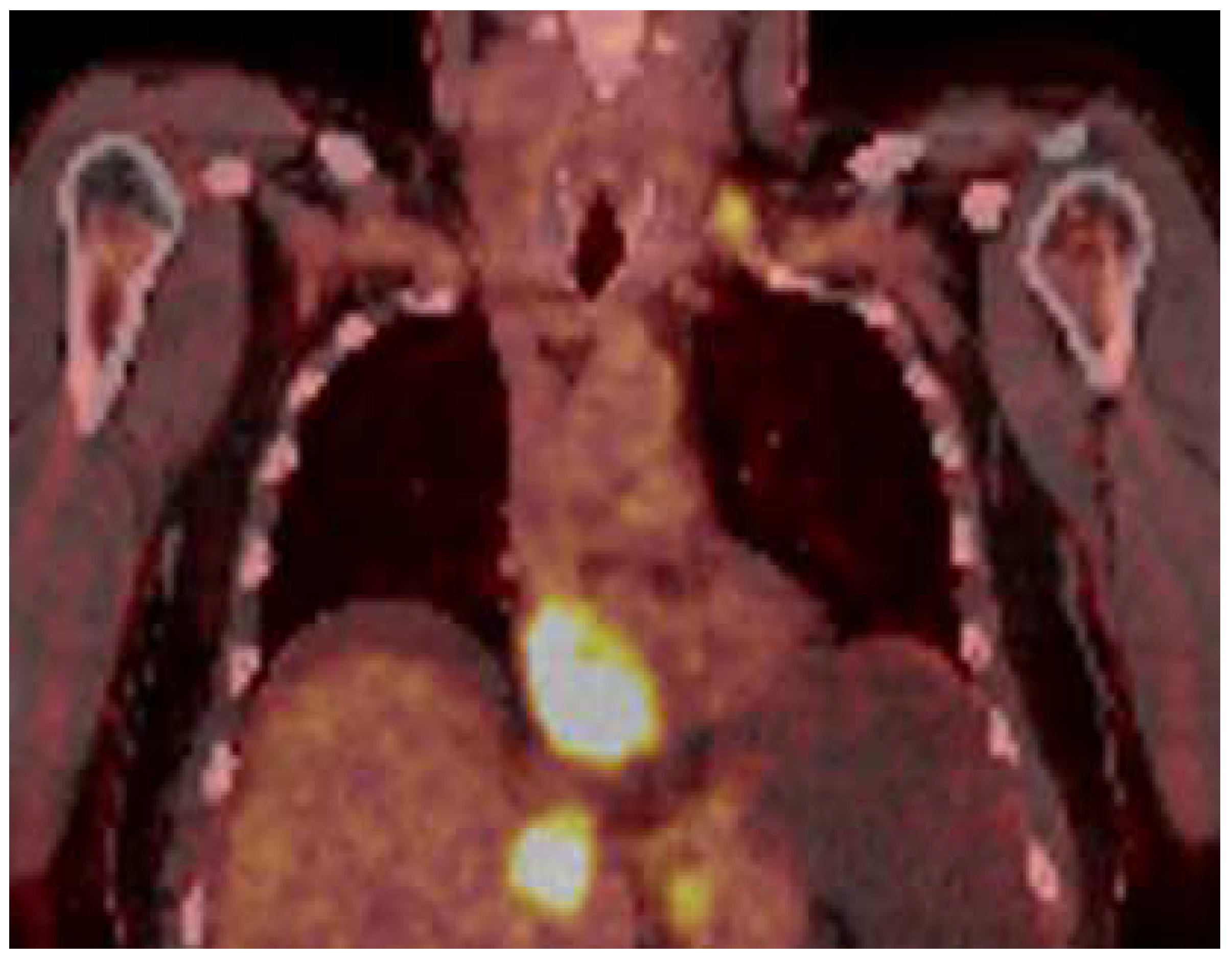 Medicina 61 00170 g002