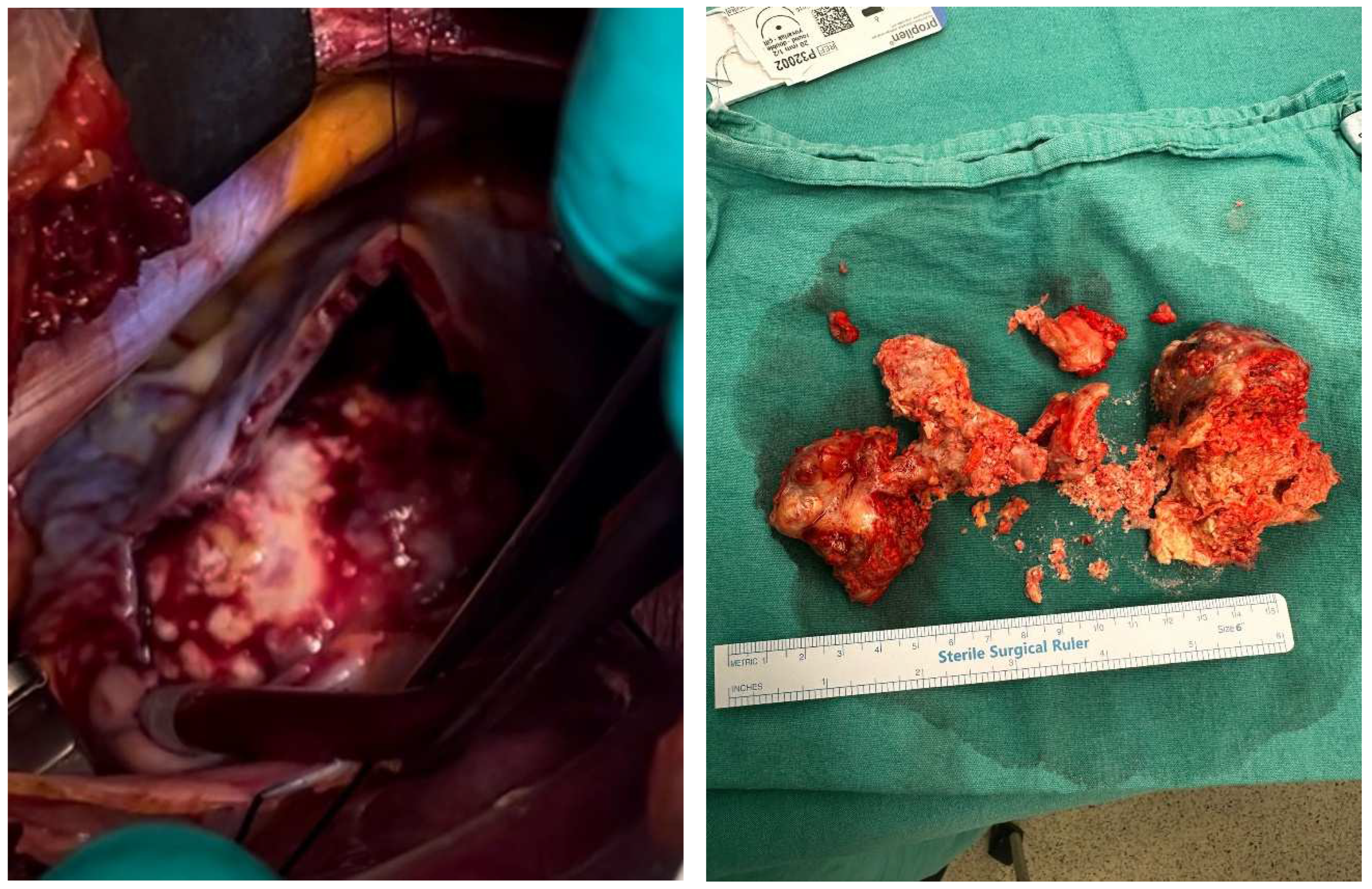 Medicina 61 00170 g003