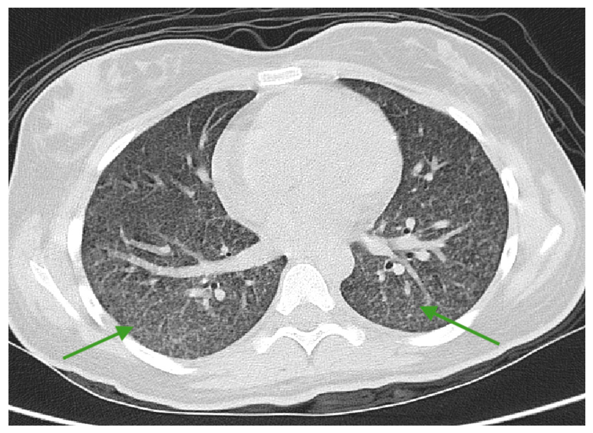 Medicina 61 00214 g004