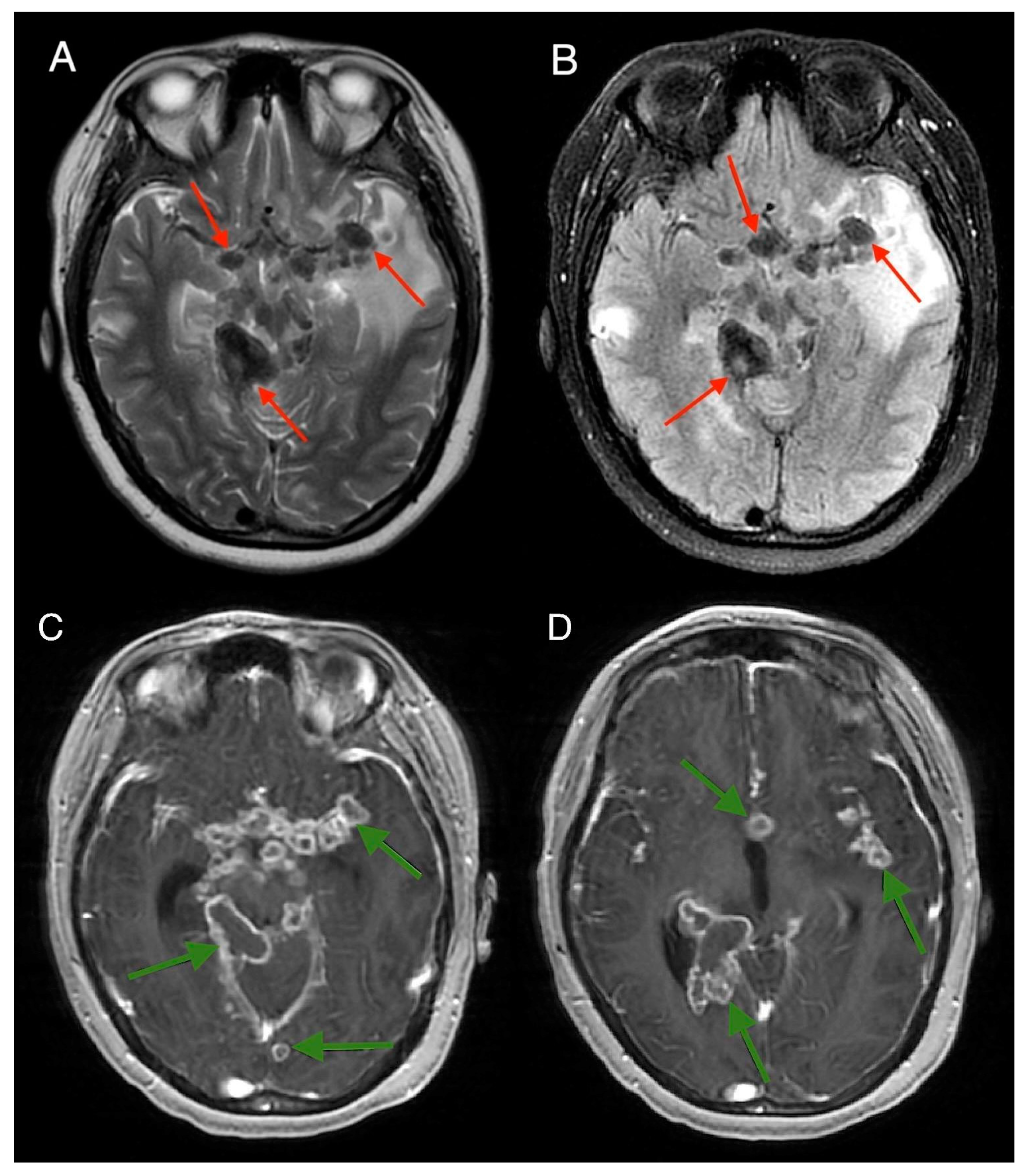 Medicina 61 00214 g006