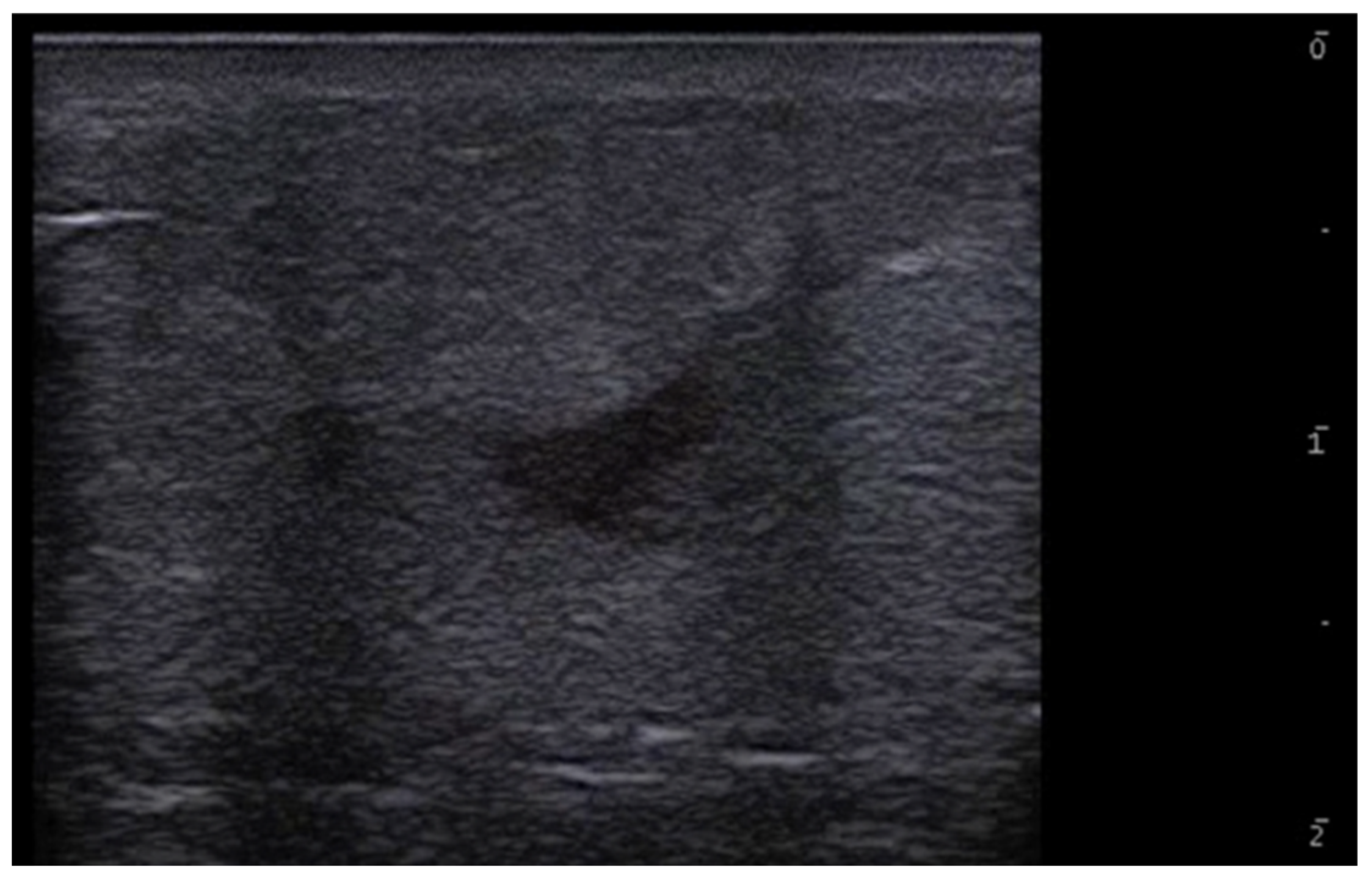 Medicina 61 00220 g004